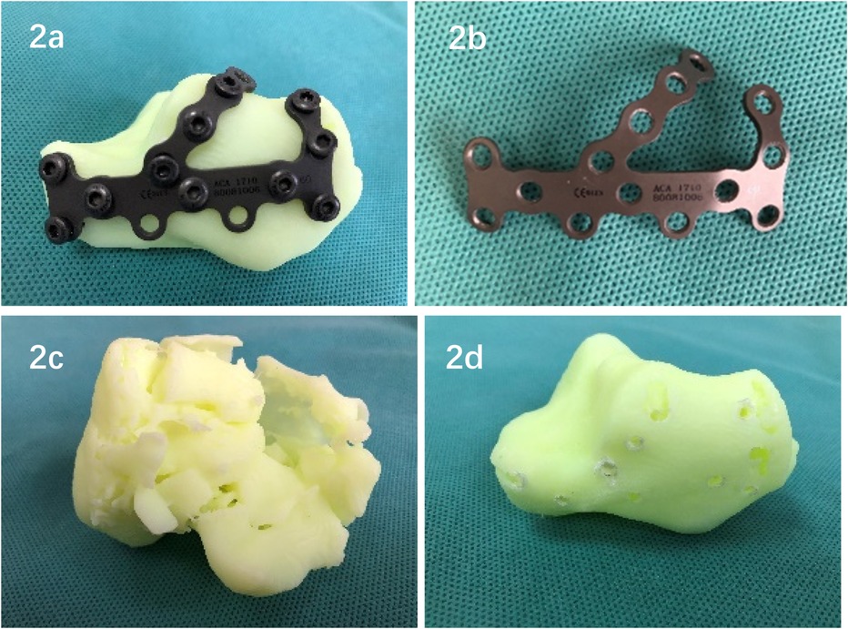 Four-panel image showing a surgical plate and a yellow model. In panel 2a, a metal plate is attached to the model. Panel 2b shows the detached plate alone. Panel 2c reveals a broken model piece. Panel 2d displays the intact model without the plate.