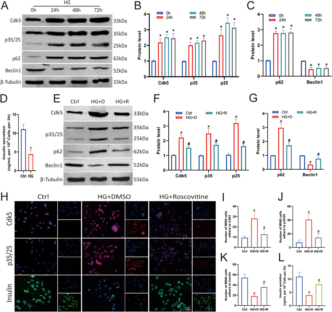 Composite image consisting of multiple panels. Panel A shows Western blot analysis of proteins Cdk5, p35/p25, p62, Beclin1, and β-Tubulin over different time points in high glucose (HG) conditions. Panels B and C present bar graphs depicting quantitative protein levels from Panel A. Panel D displays a bar graph of insulin secretion under control and HG conditions. Panel E shows Western blot analysis under control, HG+DMSO, and HG+Roscovitine conditions. Panels F and G feature bar graphs of protein quantification from Panel E. Panel H includes immunofluorescence images of Cdk5, p35/25, and insulin under different conditions. Panels I through L present bar graphs related to MN8C cell count and insulin secretion.