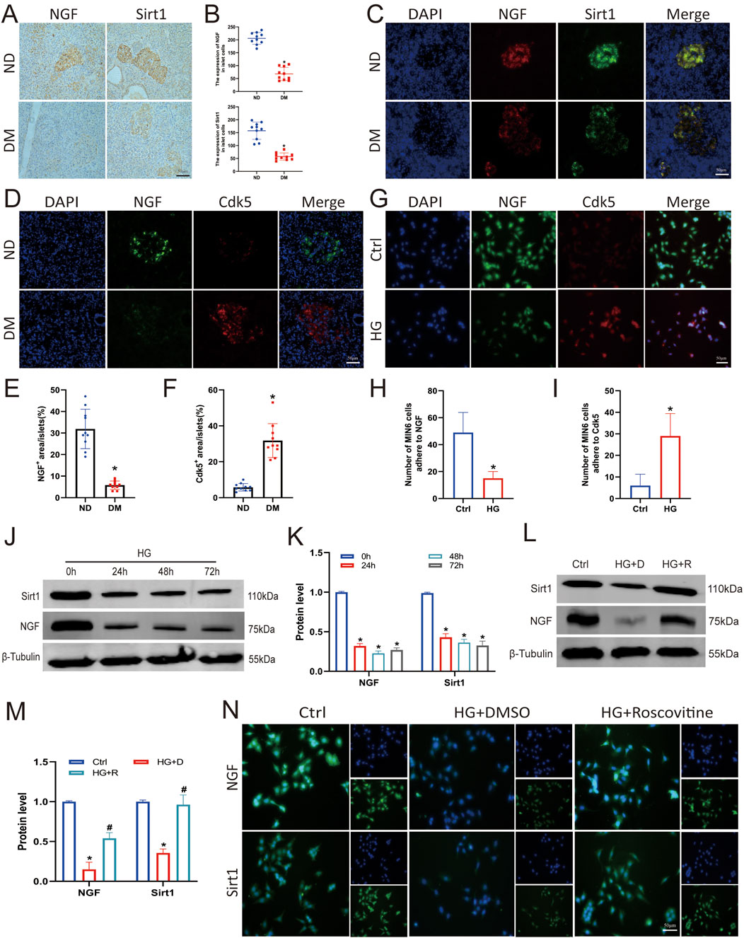 This image shows a series of panels and graphs analyzing the expression of NGF, Sirt1, and Cdk5 in different conditions. Panels A, C, D, and G illustrate stained tissue samples with markers like DAPI, NGF, Sirt1, and Cdk5, comparing non-diabetic (ND), diabetic (DM), control (Ctrl), and high glucose (HG) conditions. Graphs B, E, F, H, I, K, and M display quantitative analysis of these markers. Panels J and L show Western blot results of protein levels at different time points and treatments, while panel N presents stained samples under different conditions and treatments like HG+DMSO and HG+Roscovitine. Each panel illustrates variations in expression and localization of the markers.
