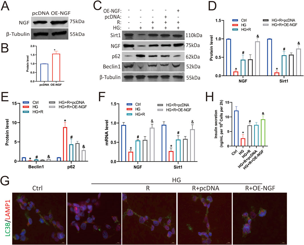 Western blot and bar graphs showing the expression levels of NGF, Sirt1, p62, Beclin1, and insulin secretion across different treatments. Image A displays a Western blot comparing NGF expression between pcDNA and OE-NGF. Graph B shows increased NGF protein levels in OE-NGF compared to pcDNA. Image C illustrates Western blots for Sirt1, NGF, p62, and Beclin1 under various conditions. Graphs D, E, F, and H depict protein and mRNA levels for NGF, Sirt1, Beclin1, p62, and insulin secretion across different experimental groups. Image G shows fluorescence microscopy images with LC3B and LAMP1 markers under control and various treatments.