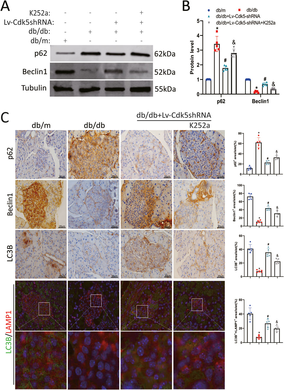 Panels show protein expression analyses. (A) Western blot results for p62, Beclin1, and Tubulin under various conditions, with molecular weights. (B) Bar graphs depict protein levels of p62 and Beclin1 across different treatments in db/m and db/db mice, with markers indicating significance. (C) Immunohistochemistry images for p62, Beclin1, and LC3B show staining patterns in pancreatic tissues from db/m, db/db, and treated db/db mice, with quantitative bar graphs beside each row. Fluorescence microscopy images at the bottom illustrate LC3B and LAMP1 localization with zoomed views highlighting details.