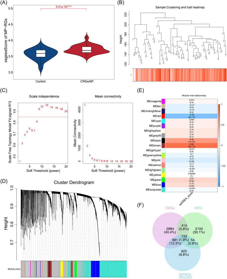 Violin plot (A) comparing MP-RGS expression scores between control and CRSwNP groups, showing a significant difference. Heatmap and dendrogram (B) illustrate sample clustering. Plots (C) display scale independence and mean connectivity against soft threshold power. Dendrogram (D) shows hierarchical clustering with module colors. Heatmap (E) represents module-trait relationships, indicating significance levels. Venn diagram (F) visualizes overlap between DEGs, MRGs, and MPRGs identified through WGCNA analysis.