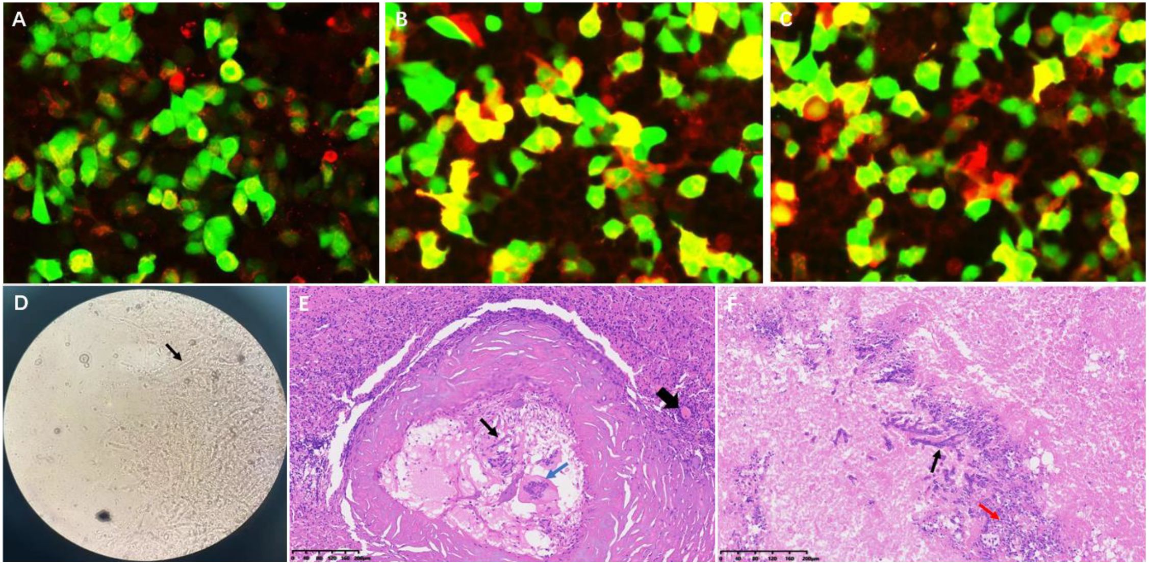 Panel A to C shows fluorescence microscopy images with green and red staining of cells. Panel D depicts a microscopic view of a round organism with an arrow indicating a specific area. Panel E and F display histological sections with pink and purple staining, highlighting structures with black and colored arrows for emphasis.