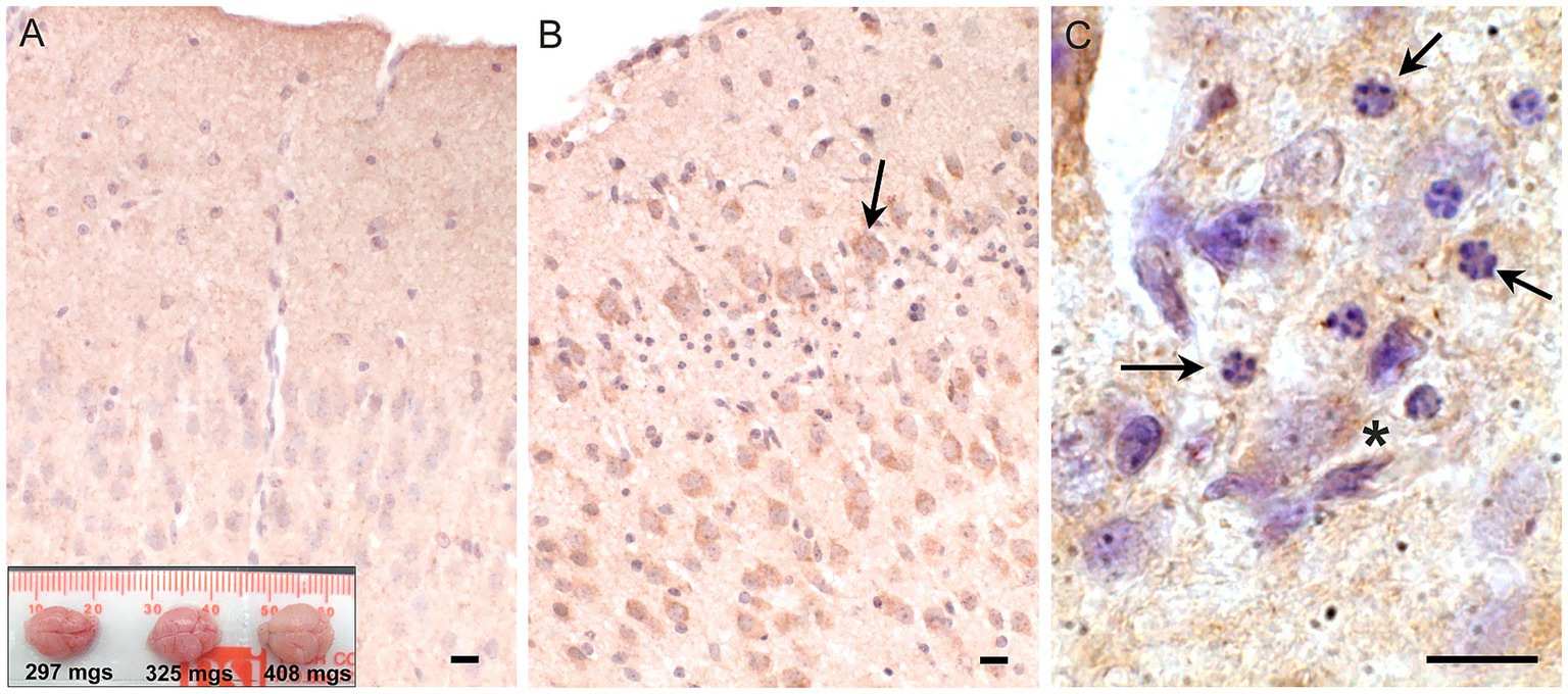 Histological image showing three panels labeled A, B, and C. Panel A depicts a brain tissue section with scattered nuclei. Panel B shows a denser tissue section with clustered nuclei and an arrow pointing to a specific area. Panel C displays a magnified view highlighting several nuclei with arrows and an asterisk indicating particular features. An inset at the bottom shows three small brains labeled with weights: 297 milligrams, 325 milligrams, and 408 milligrams. Scale bars are present in each panel for reference.