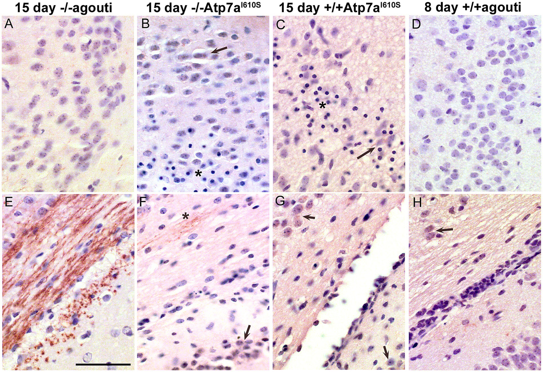 Histological images showing cellular arrangements and staining variations in different conditions. Panels A to D display cellular morphology at different ages and genetic configurations, with differences in color intensity and cell density. Panels E to H illustrate cellular structures with varying staining patterns and cellular components marked by arrows and asterisks, highlighting specific features or variations in expression.