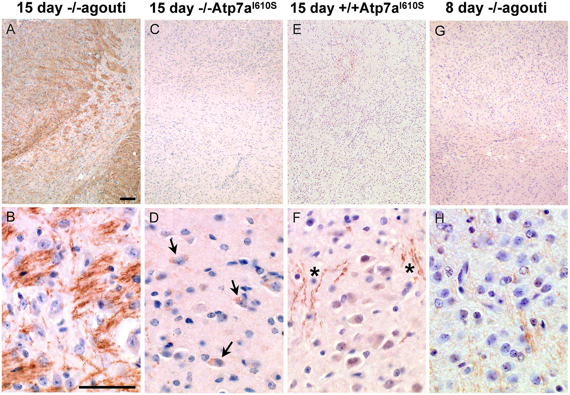 Microscopic images showing brain tissue sections under different conditions. Panels A and B display dense staining in 15-day agouti tissues. Panel C shows sparse staining in 15-day Atp7a^I61OS knockout tissue. Panel E depicts moderate staining in 15-day Atp7a^I61OS wild-type tissue. Panel G shows light staining in 8-day agouti tissue. Panels D, F, and H are close-ups of each condition, highlighting cellular details with arrows and asterisks indicating specific structures.