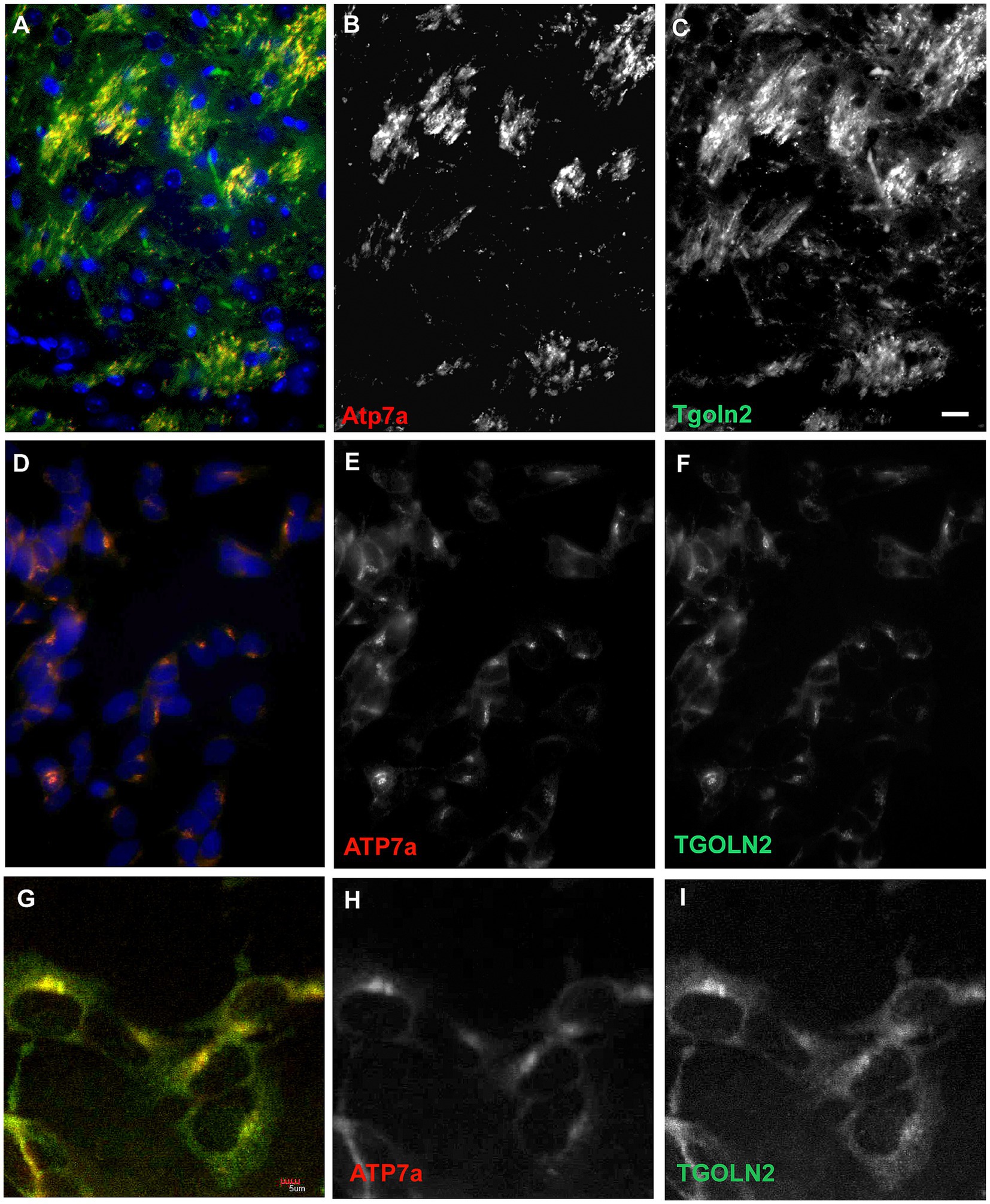 Fluorescence microscopy images display the localization of ATP7A and TGNOL2 proteins in cells. Panels A to I depict various magnifications and color combinations showing protein distributions. Images include merged and individual channel views, highlighting ATP7A in red and TGNOL2 in green. Nuclei are stained blue in merged images.