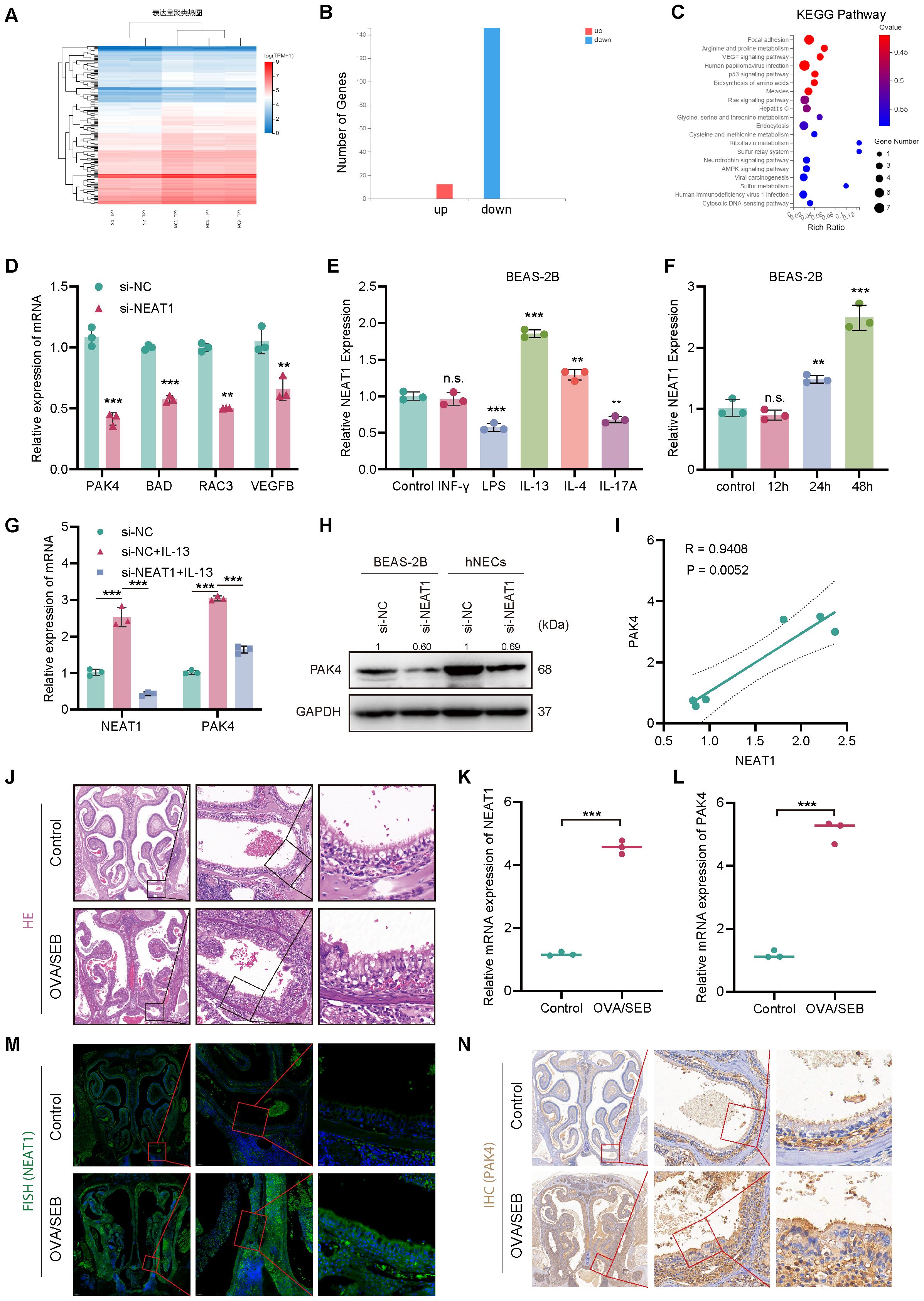 Various data visualizations and images related to gene expression and cellular studies. Panel A: Heatmap displaying differentially expressed genes. Panel B: Bar chart showing the count of upregulated and downregulated genes. Panel C: KEGG pathway analysis with dot plot indicating rich ratio and gene numbers. Panel D, E, F, G: Bar graphs illustrating relative expression levels of specific mRNAs under different conditions. Panel H: Western blot analysis for PAK4 protein expression in BEAS-2B and hNECs cells compared to GAPDH. Panel I: Scatter plot showing correlation between NEAT1 and PAK4 expression. Panel J: H&E staining of control and OVA/SEB-treated tissues. Panel K, L: Bar charts of NEAT1 and PAK4 mRNA expression in control vs. OVA/SEB. Panel M: FISH imaging for NEAT1 in control and treated tissues. Panel N: IHC staining for PAK4 in control and treated samples.