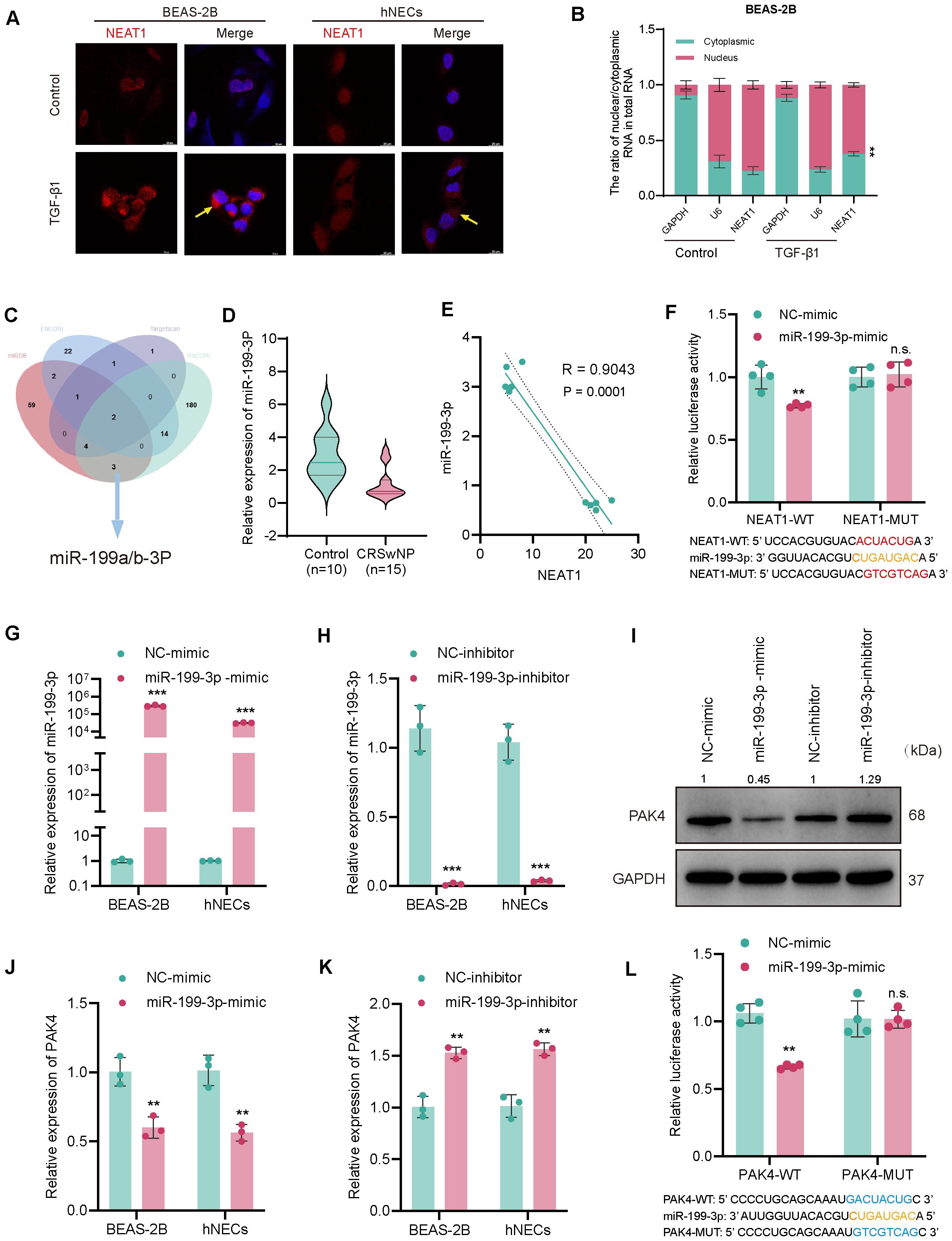 A scientific figure consisting of multiple panels showing experimental data. Panel A shows immunofluorescence images of NEAT1 expression in BEAS-2B and hNECs with TGF-β1 treatment, indicated by arrows. Panel B is a bar graph showing nuclear and cytoplasmic RNA ratios in BEAS-2B cells under different conditions. Panel C presents a Venn diagram illustrating miR-199a/b-3P interactions. Panel D displays a violin plot comparing miR-199a-3P expression in control and CRSwNP samples. Panel E is a scatter plot with correlation analysis between NEAT1 and miR-199-3p. Panels F to L include bar graphs showing luciferase activity, miR-199-3p, and PAK4 expression under different treatments. Panel I shows a Western blot analysis of PAK4 protein levels. Statistical significance is indicated throughout.