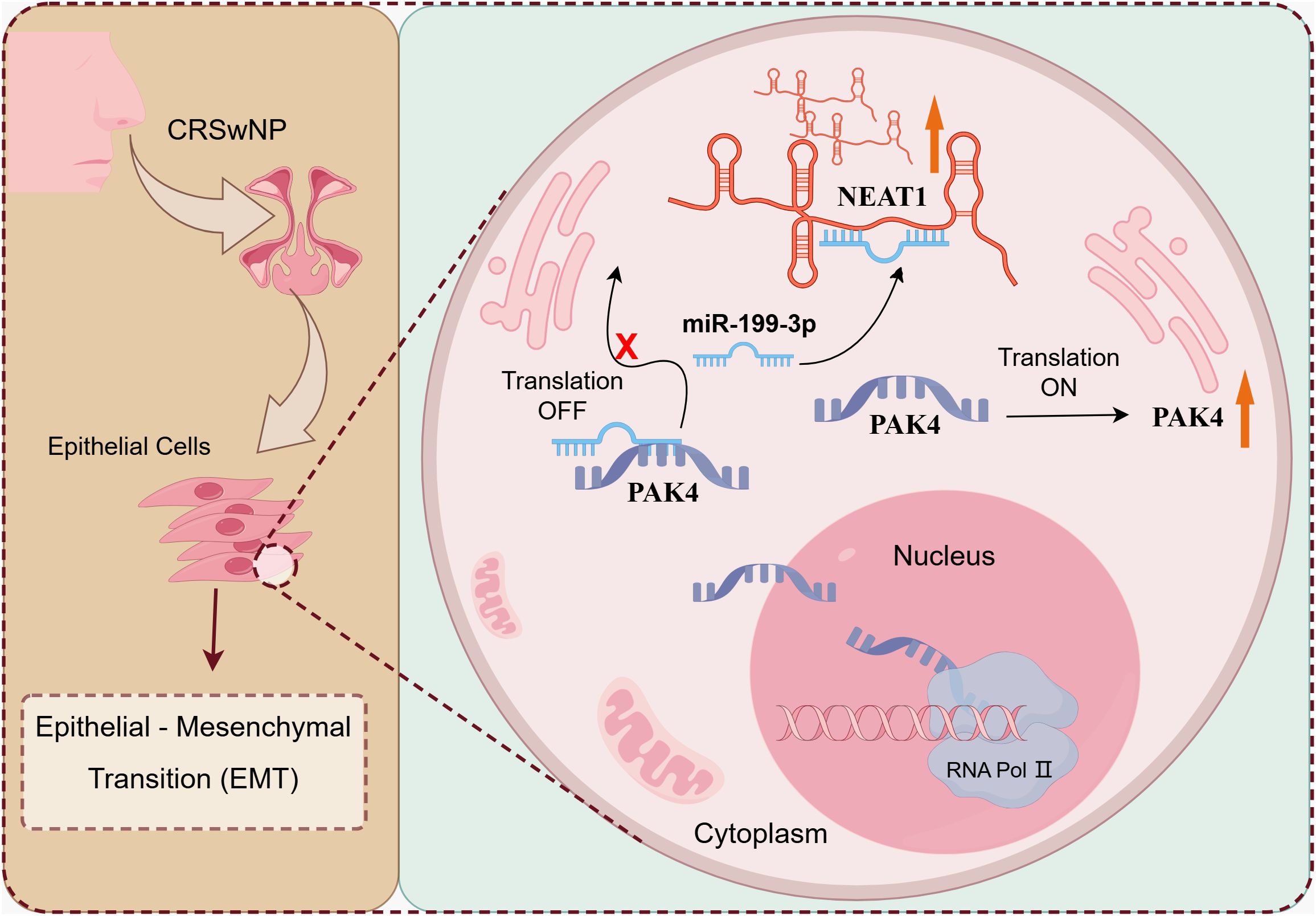 Diagram illustrating the role of NEAT1 in epithelial cells during the epithelial-mesenchymal transition (EMT) related to chronic rhinosinusitis with nasal polyps (CRSwNP). NEAT1 regulates miR-199-3p and PAK4 expression, influencing translation processes within the nucleus and cytoplasm. Arrows depict the direction of interactions and effects.