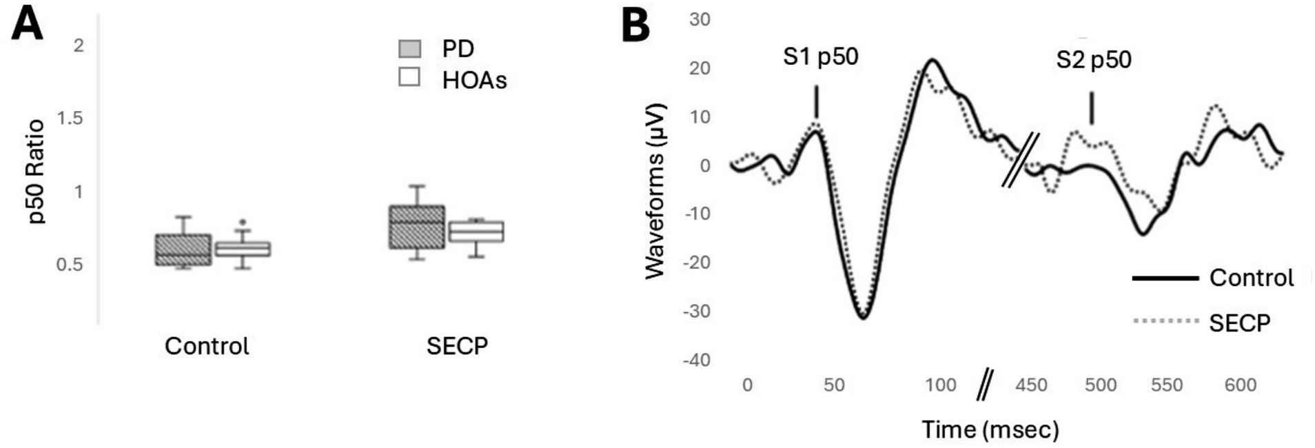 (A) A boxplot comparing p50 ratio between control and SECP groups, showing differences between PD and HOAs. (B) A waveform chart illustrating control and SECP responses over time, with marked S1 and S2 p50 peaks.