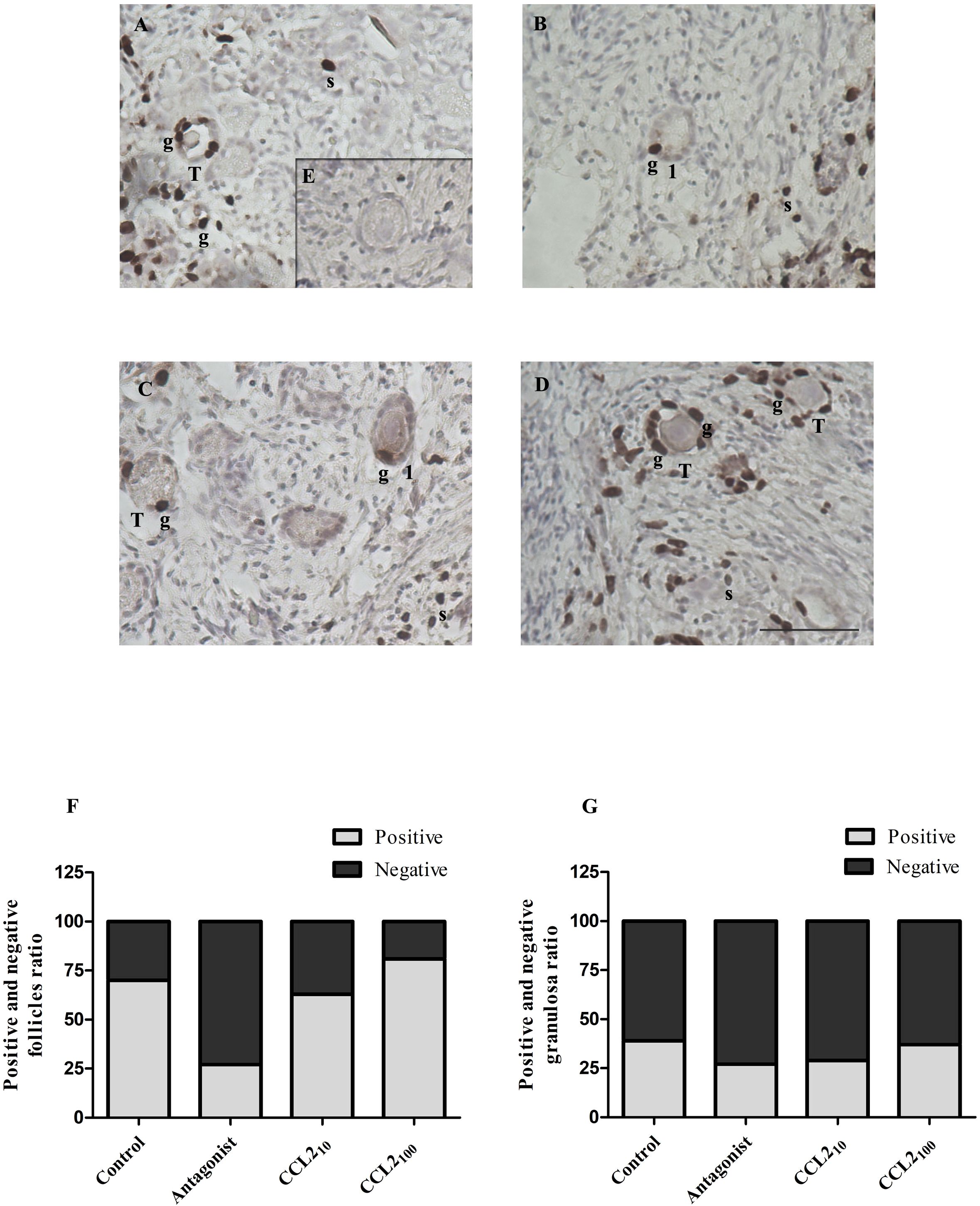 Histological images (from A to D) across four groups: Control, Antagonist, CCL2_10, and CCL2_100 show different ovarian tissue sections with labeled structures: granulosa cells (g), stroma (s), transitional (T), and primary follicles (1). Each image depicts variations in positive immunostaining (shown in brown) of Brdu IHC. Inset depicts negative control with no staining. Graphs F and G display bar charts comparing positive and negative ratios of follicles and granulosa cells across all groups.
