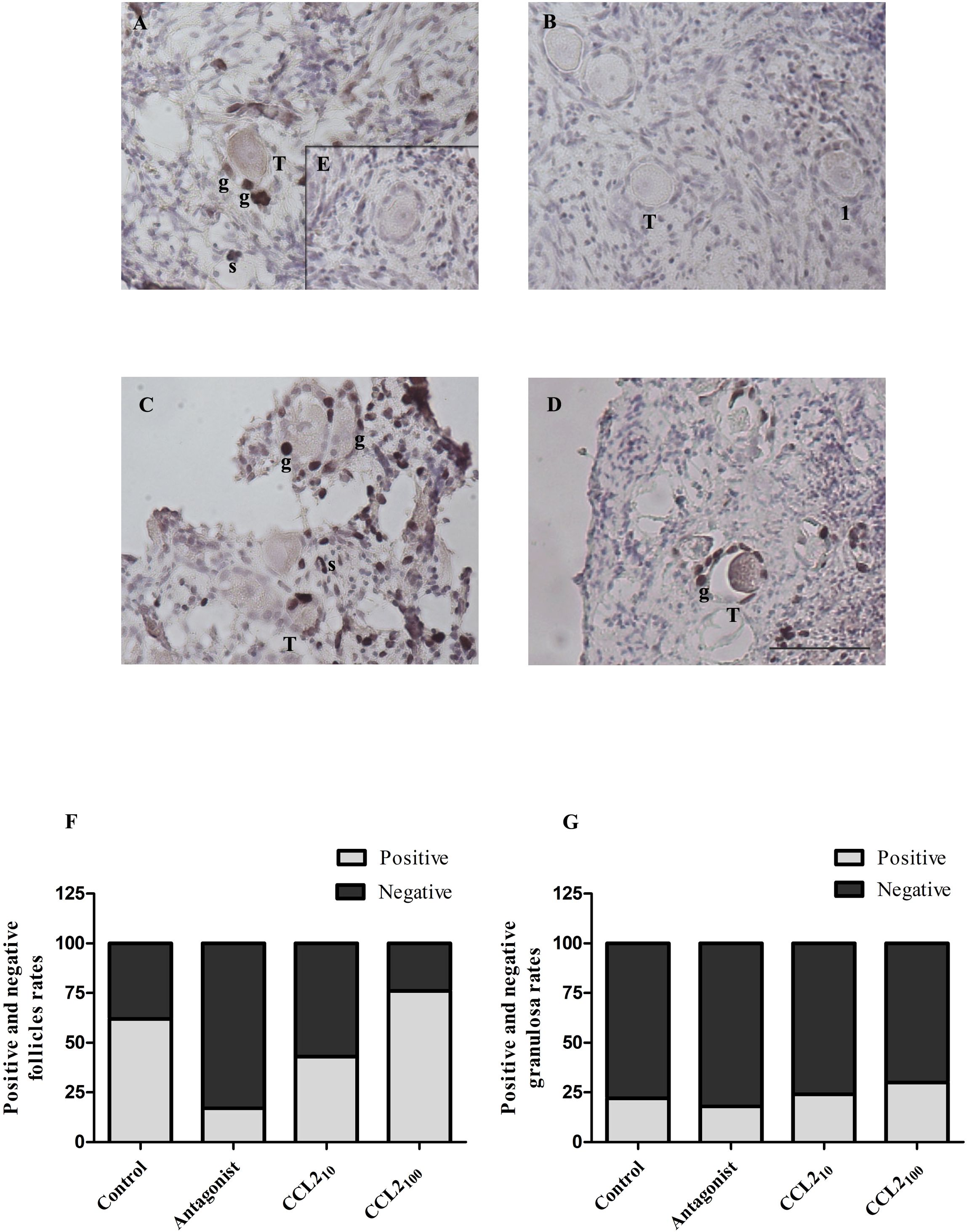 Histological images (A-D) across four groups: Control, Antagonist, CCL2_10, and CCL2_100 show different ovarian tissue sections with labeled structures: granulosa cells (g), stroma (s), transitional (T), and primary follicles (1). Each image depicts variations in positive immunostaining (shown in brown) of Ki67 IHC with an inset showing no staining for the negative control. Graphs (F, G) display bar charts comparing positive and negative ratios of follicles and granulosa cells across all groups.
