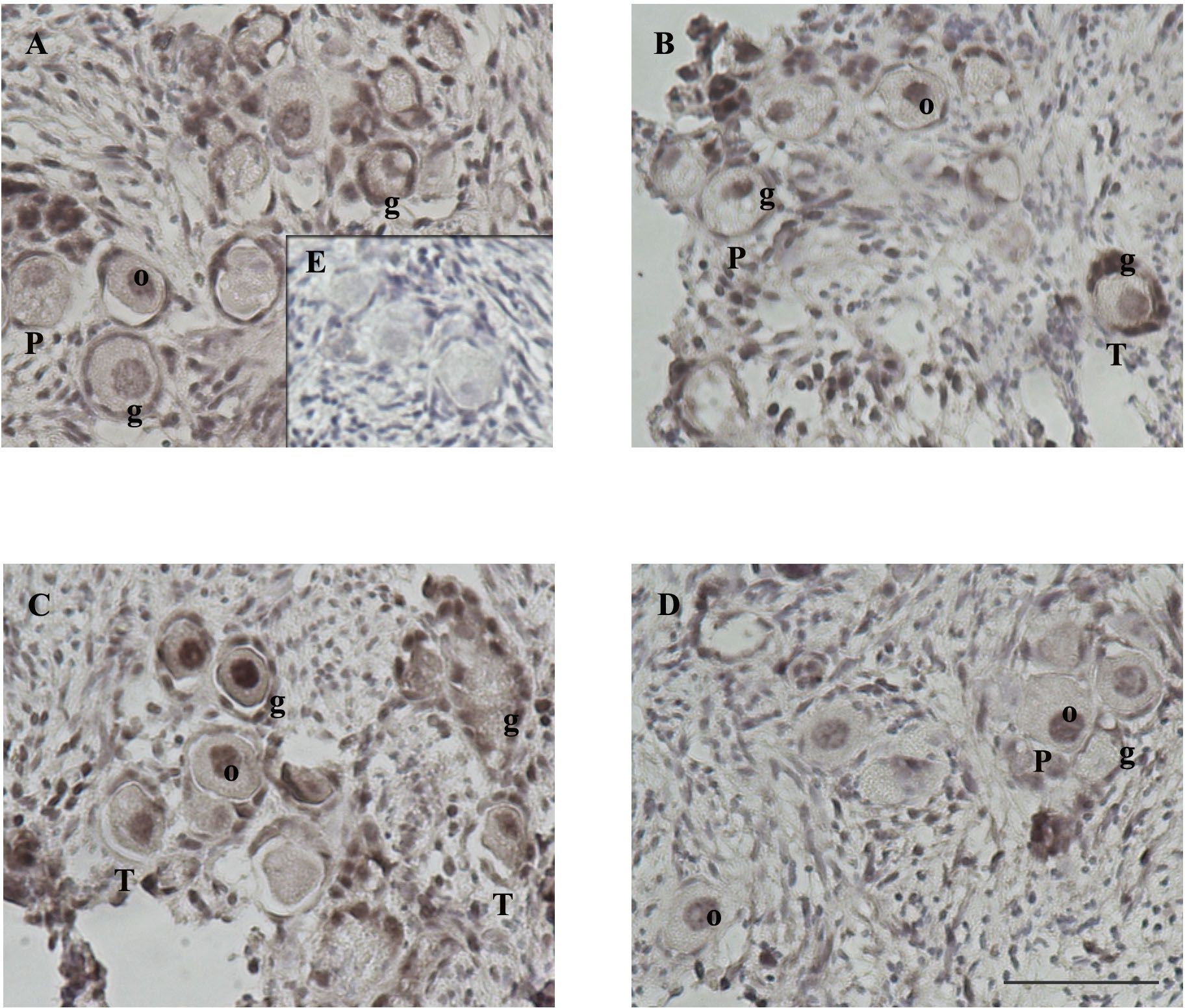Histological slides labeled A, B, C, and D showing ovarian tissue sections from four groups: Control, Antagonist, CCL2_10, and CCL2_100 labeled for AKTp showed in brown with different structures marked as “o,” “g,” “P,” and “T.” Slide E is an inset with a negative control showing no staining.