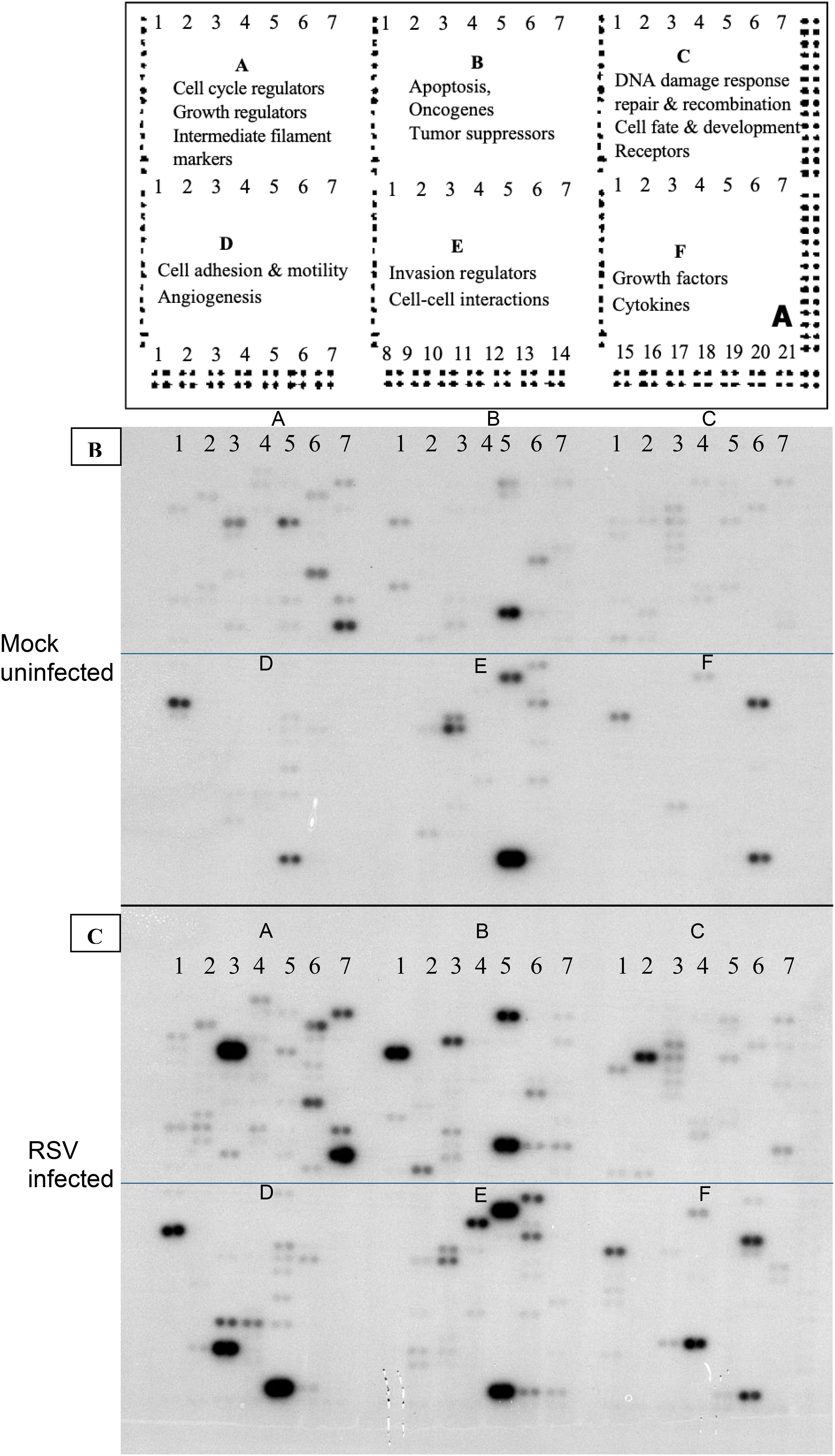 Scientific analysis showing gene expression on a blot. Sections labeled A to F categorize functions like cell cycle regulation, apoptosis, DNA response, and growth factors. “Mock uninfected” and “RSV infected” conditions are compared, showing varying expression patterns. Dark spots indicate gene activity levels.