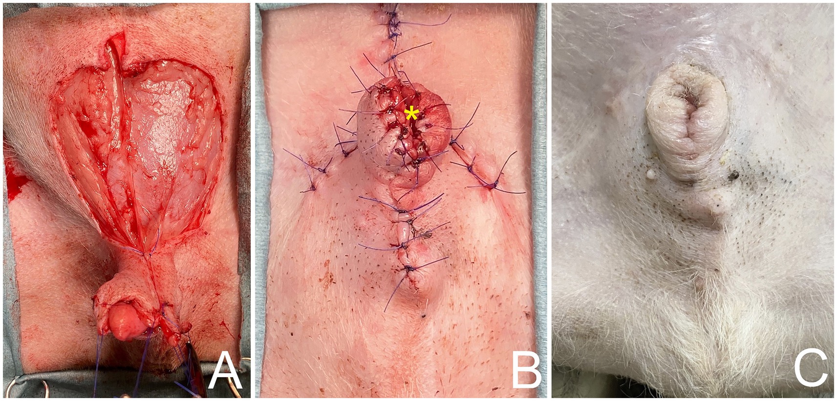 A three-panel medical image showing stages of a surgical procedure. Panel A displays an open incision on skin with visible underlying tissue. Panel B shows stitches closing the wound, marked by a yellow asterisk. Panel C, labeled 'C', depicts fully healed skin with minimal scarring.