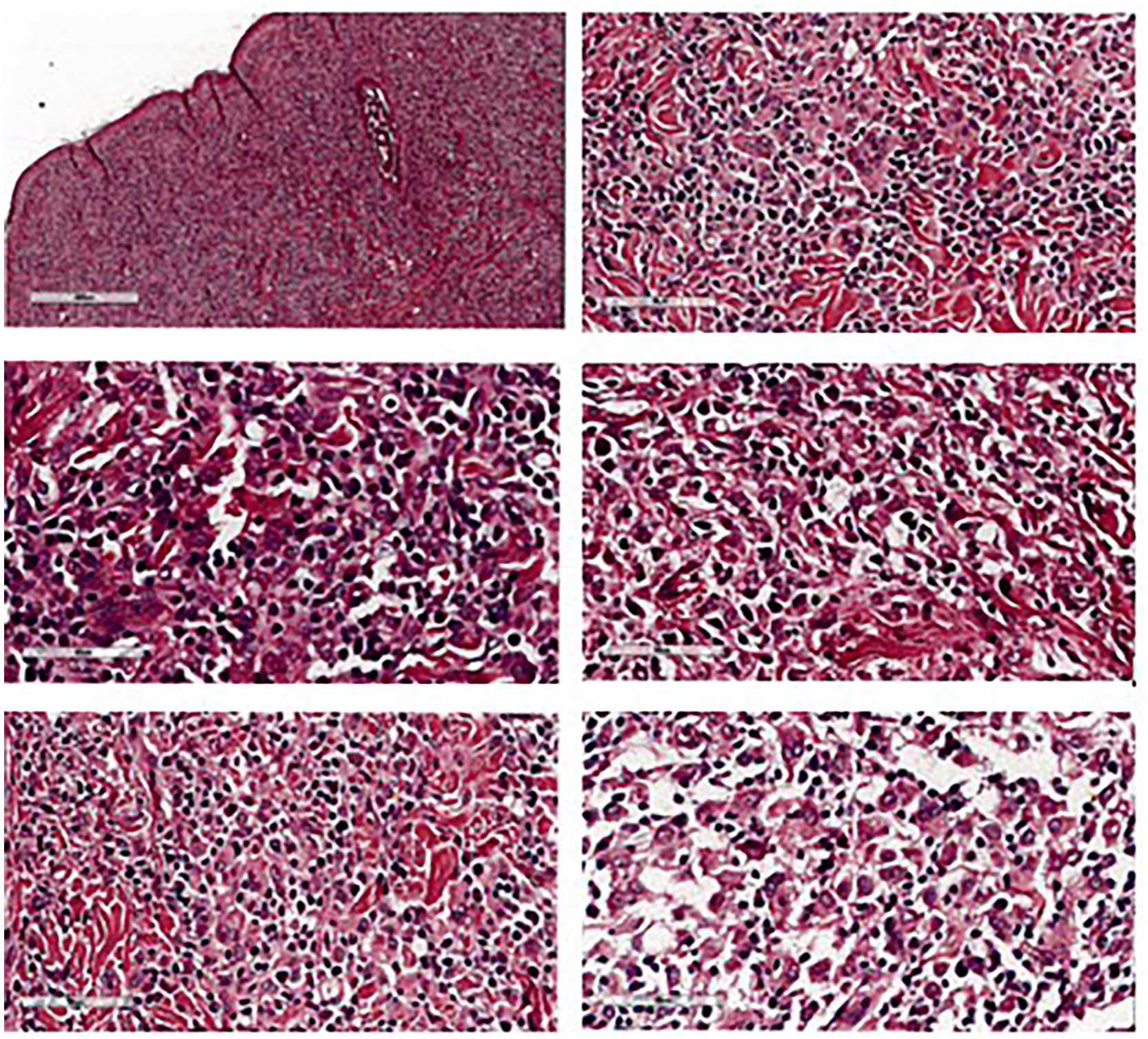 Microscopic images of tissue sections show densely packed cells stained in varying shades of pink and purple. The top left image provides a wider view, while the other images focus on denser clusters with noticeable cellular structures and nuclei.