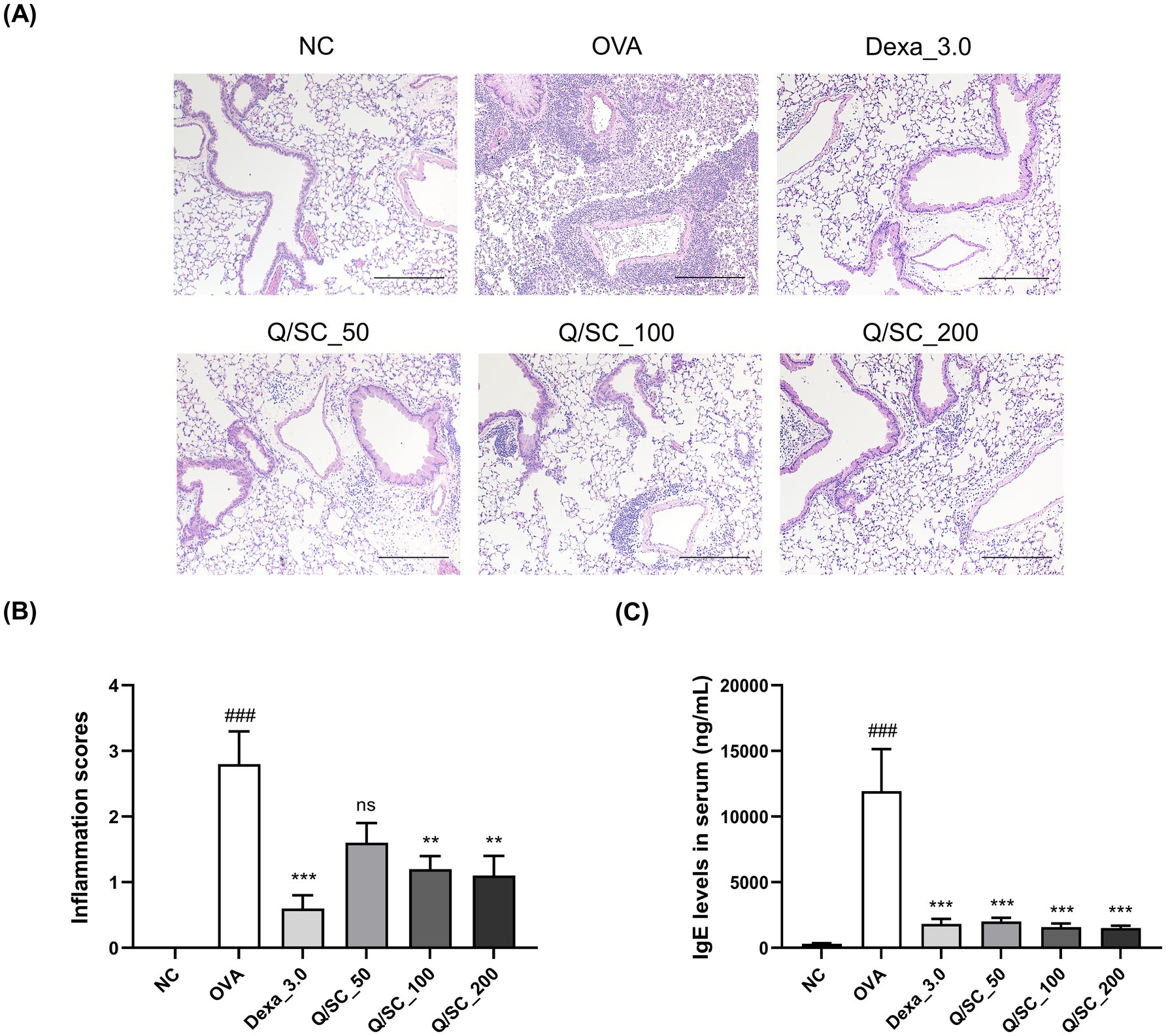 (A) Histological images show lung tissue under different treatment conditions labeled NC, OVA, Dexa_3.0, Q/SC_50, Q/SC_100, and Q/SC_200. (B) Bar graph depicting inflammation scores across these treatments, with OVA showing the highest score. (C) Bar graph of IgE levels in serum, with OVA having the highest level. Significance is indicated by symbols.