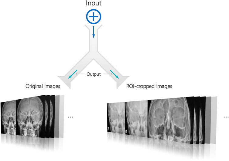 Flowchart illustrating the process of converting original X-ray images into ROI-cropped images. Two sets of stacked X-rays labeled