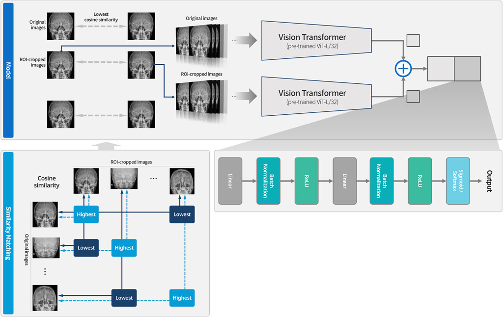 Diagram illustrating a model pipeline for processing skull X-ray images. The process involves original and region of interest (ROI)-cropped images being analyzed by Vision Transformers, pre-trained with ViT-L/32. Cosine similarity matches original images with highest and lowest similarities to ROI-cropped images. Yields are processed through linear, batch normalization, ReLU, and sigmoid/softmax layers for output.
