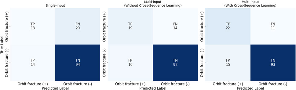 Confusion matrices comparing three models for predicting orbit fractures. From left to right: Single-input model with true positives (TP) 13, false negatives (FN) 20, false positives (FP) 14, true negatives (TN) 94; Multi-input without cross-sequence learning: TP 19, FN 14, FP 16, TN 92; Multi-input with cross-sequence learning: TP 22, FN 11, FP 15, TN 93.
