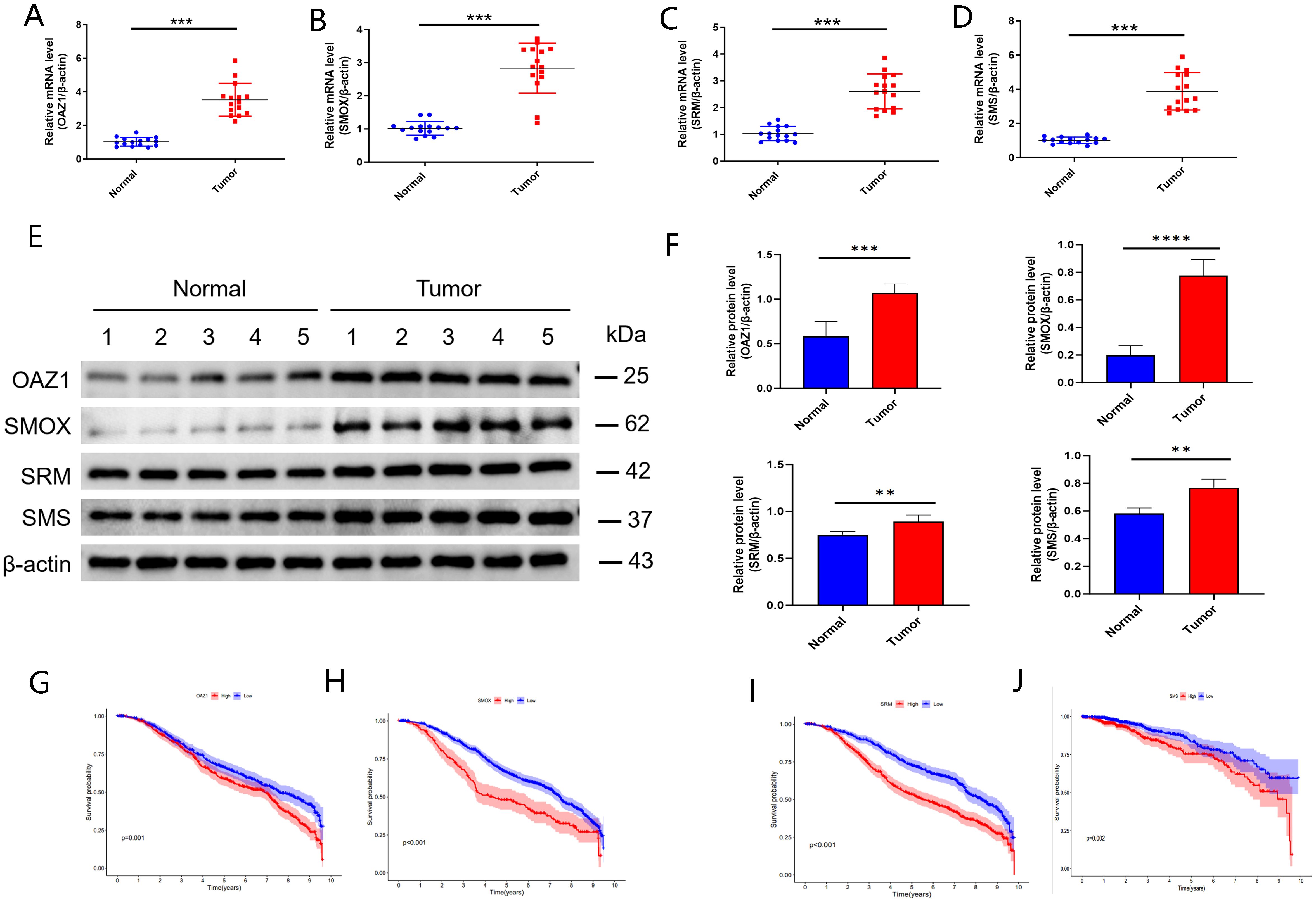 Graphs and data visualizations depicting gene expression and protein levels in normal versus tumor samples. A-D: Scatter plots showing significant increases in mRNA levels of OAZ1, SMOX, SRM, and SMS in tumor samples. E: Western blot analysis for these proteins with β-actin as a control. F: Bar charts displaying significant increases in protein levels in tumors. G-J: Kaplan-Meier survival curves correlating high expression of OAZ1, SMOX, SRM, and SMS with decreased survival rates, with p-values indicating statistical significance.