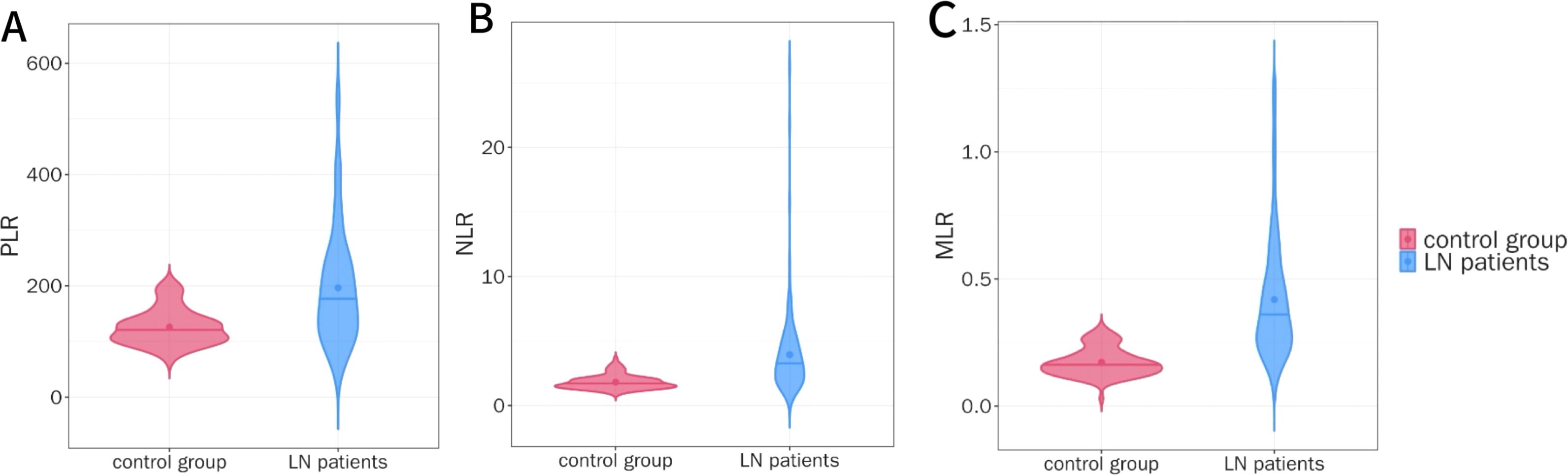 Three violin plots compare control groups and LN patients. Plot A shows PLR, higher in LN patients. Plot B shows NLR, also higher in LN patients. Plot C shows MLR, only for control group. Red represents control; blue represents LN patients.