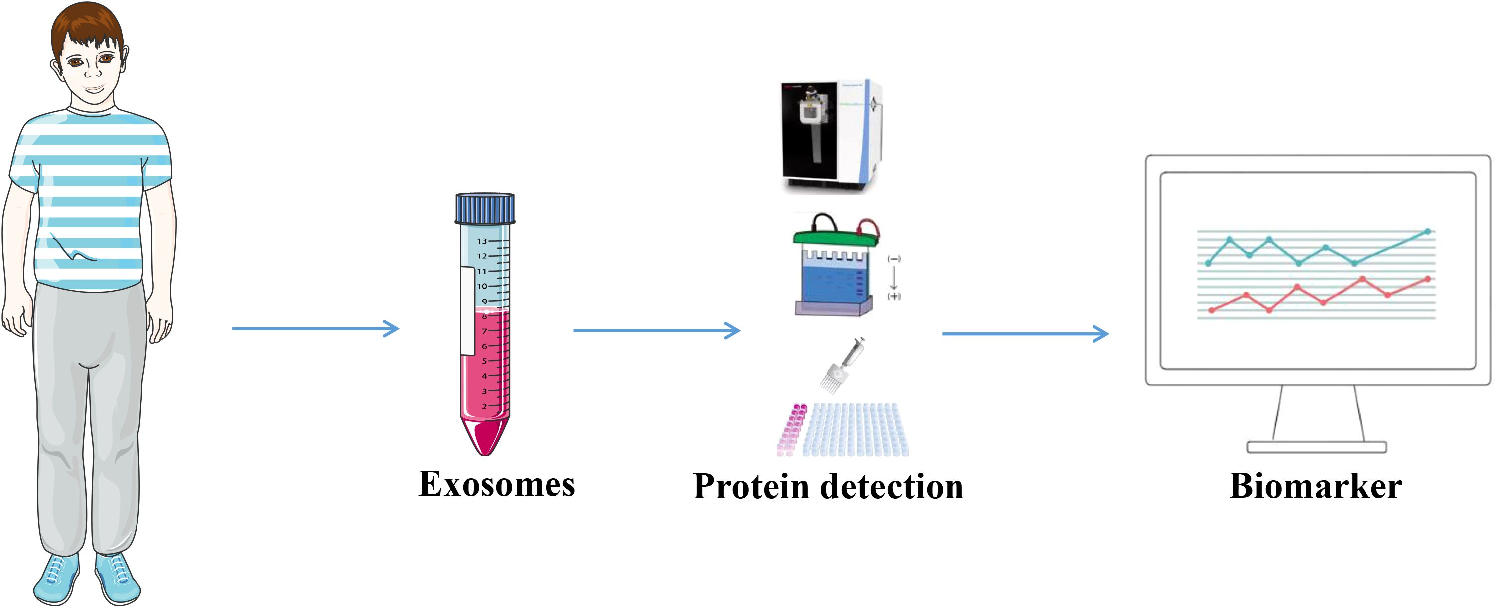 Illustration depicting a process flowchart. A person on the left indicates the starting point. An arrow points to a test tube labeled “Exosomes,” followed by another arrow leading to a series of images, including laboratory equipment, indicating “Protein detection.” A final arrow points to a computer monitor displaying graphs, labeled “Biomarker.