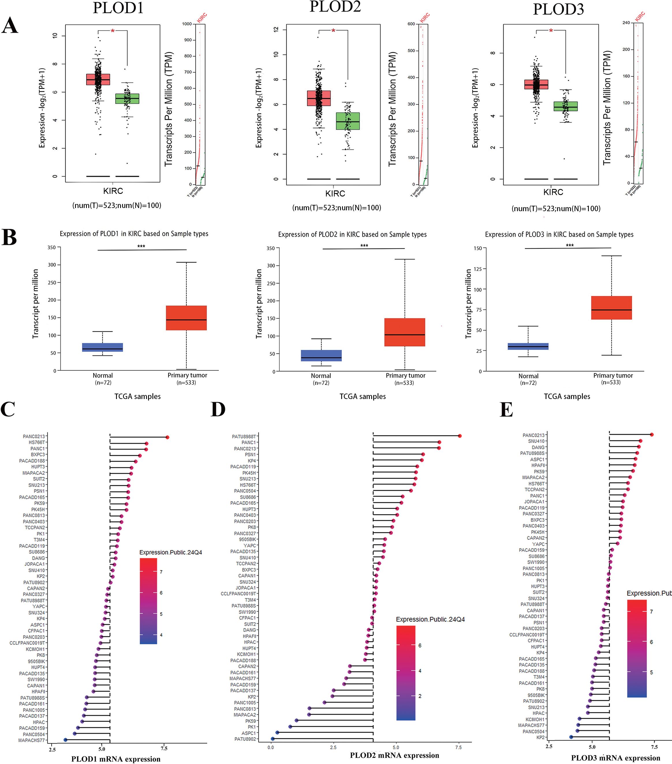 Charts showing PLOD1, PLOD2, and PLOD3 expression in cancer. Panel A displays box plots of expression in normal and tumor samples. Panel B shows box plots from TCGA samples comparing normal and primary tumor expression. Panels C, D, and E present ranked mRNA expression levels for PLOD1, PLOD2, and PLOD3, respectively, with color gradients indicating expression levels.