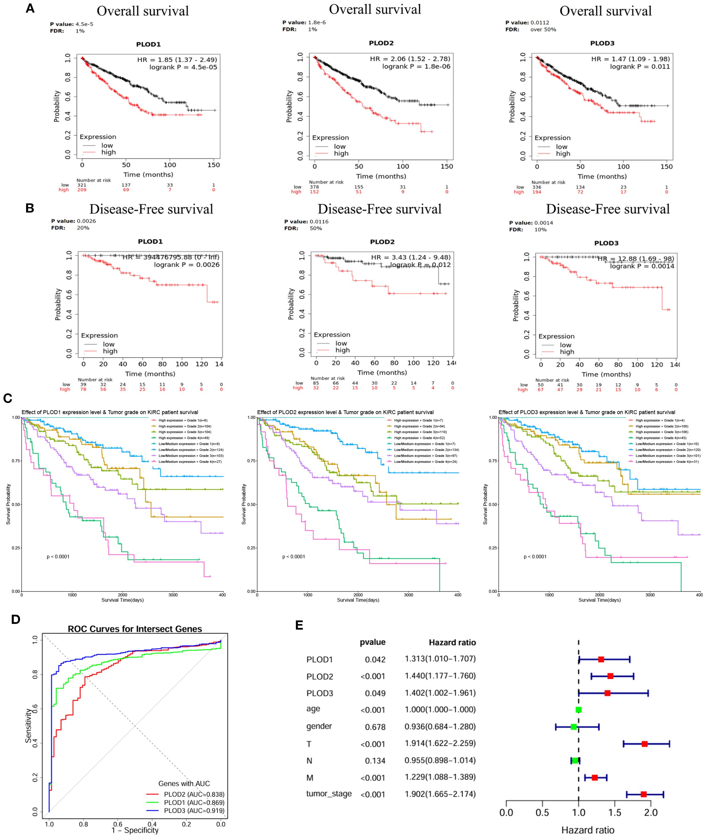 Graphs and a table showing survival analysis for PLOD1, PLOD2, and PLOD3 genes. Panels A and B present Kaplan-Meier plots for overall and disease-free survival, highlighting statistical significance with hazard ratios. Panel C shows survival probability plots. Panel D features ROC curves for gene intersections, indicating high AUC values for PLOD genes. Panel E includes a table and forest plot displaying p-values and hazard ratios for gene expressions and clinical variables, illustrating their impact on survival.