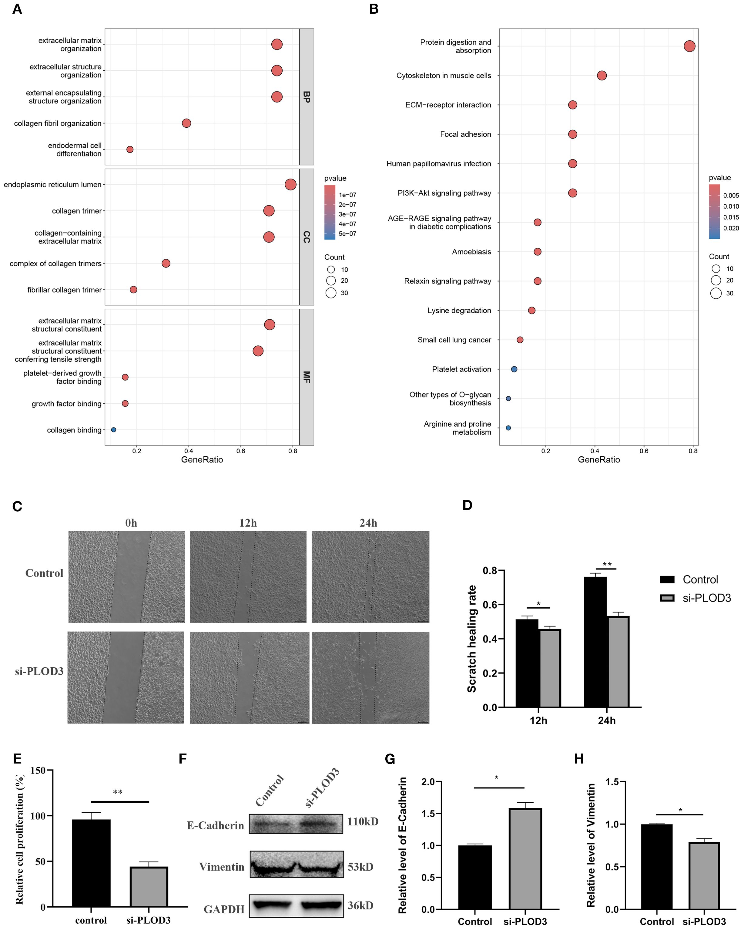 Gene ontology and KEGG pathway analyses are shown in panels A and B with dot plots indicating significant pathways related to extracellular matrix organization. Panel C displays microscopic images comparing cell migration in control and si-PLOD3 groups at 0, 12, and 24 hours. Panel D presents a bar graph of the scratch healing rate with significant differences marked. Panel E shows relative cell proliferation between control and si-PLOD3 groups. Panel F includes western blot results for E-Cadherin and Vimentin proteins with GAPDH as a control. Panels G and H display quantifications of E-Cadherin and Vimentin levels, respectively.