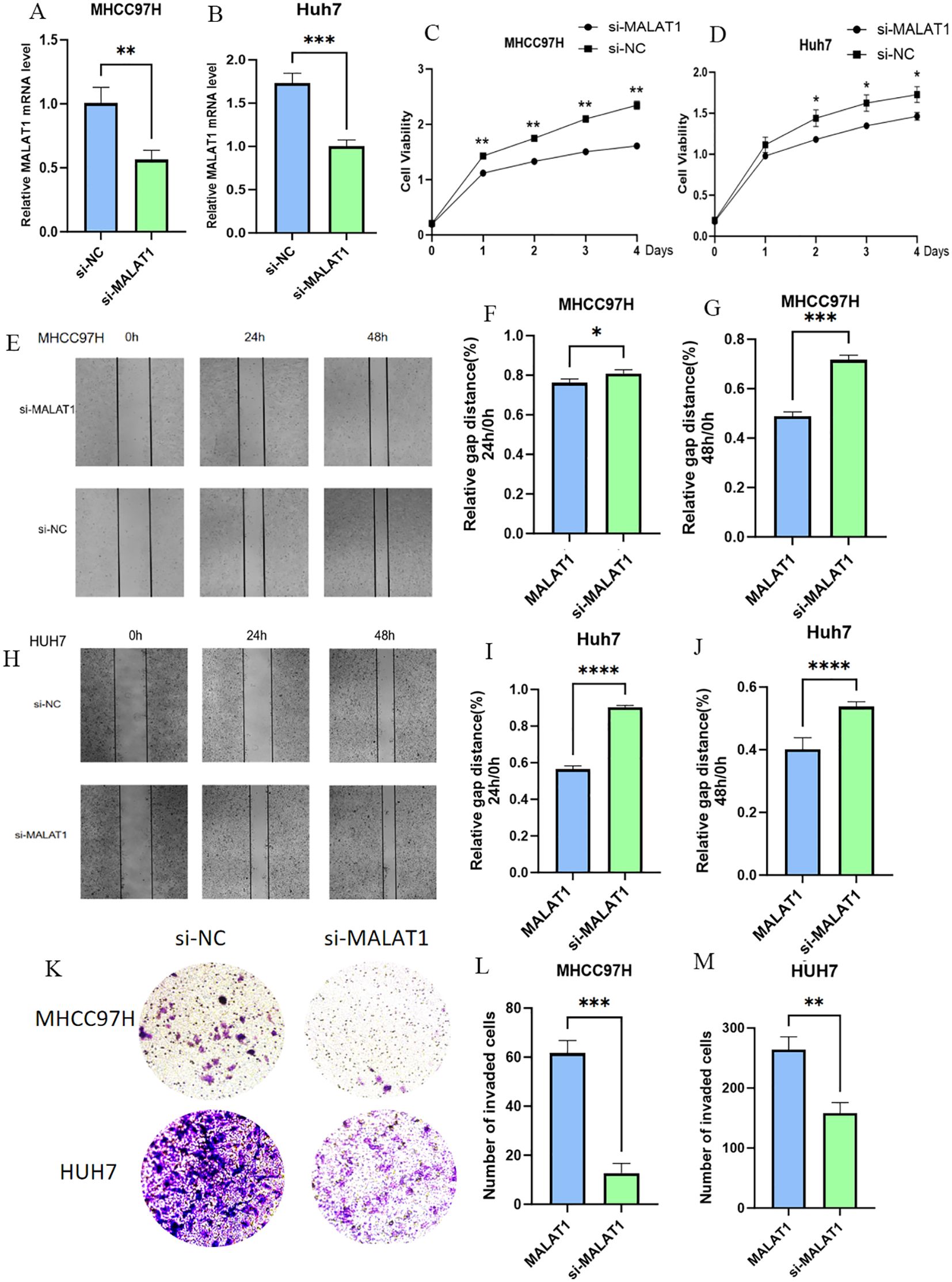 Charts and images display the effects of si-MALAT1 on MHCC97H and Huh7 cell lines. Bar graphs (A, B) show reduced MALAT1 mRNA levels. Line graphs (C, D) indicate decreased cell viability over four days. Wound healing assays (E, H) depict reduced gap closure over time. Bar graphs (F, G, I, J) quantify relative gap distances at various times. Image (K) and bar graphs (L, M) show reduced cell invasion with si-MALAT1. Statistically significant changes are marked with asterisks.
