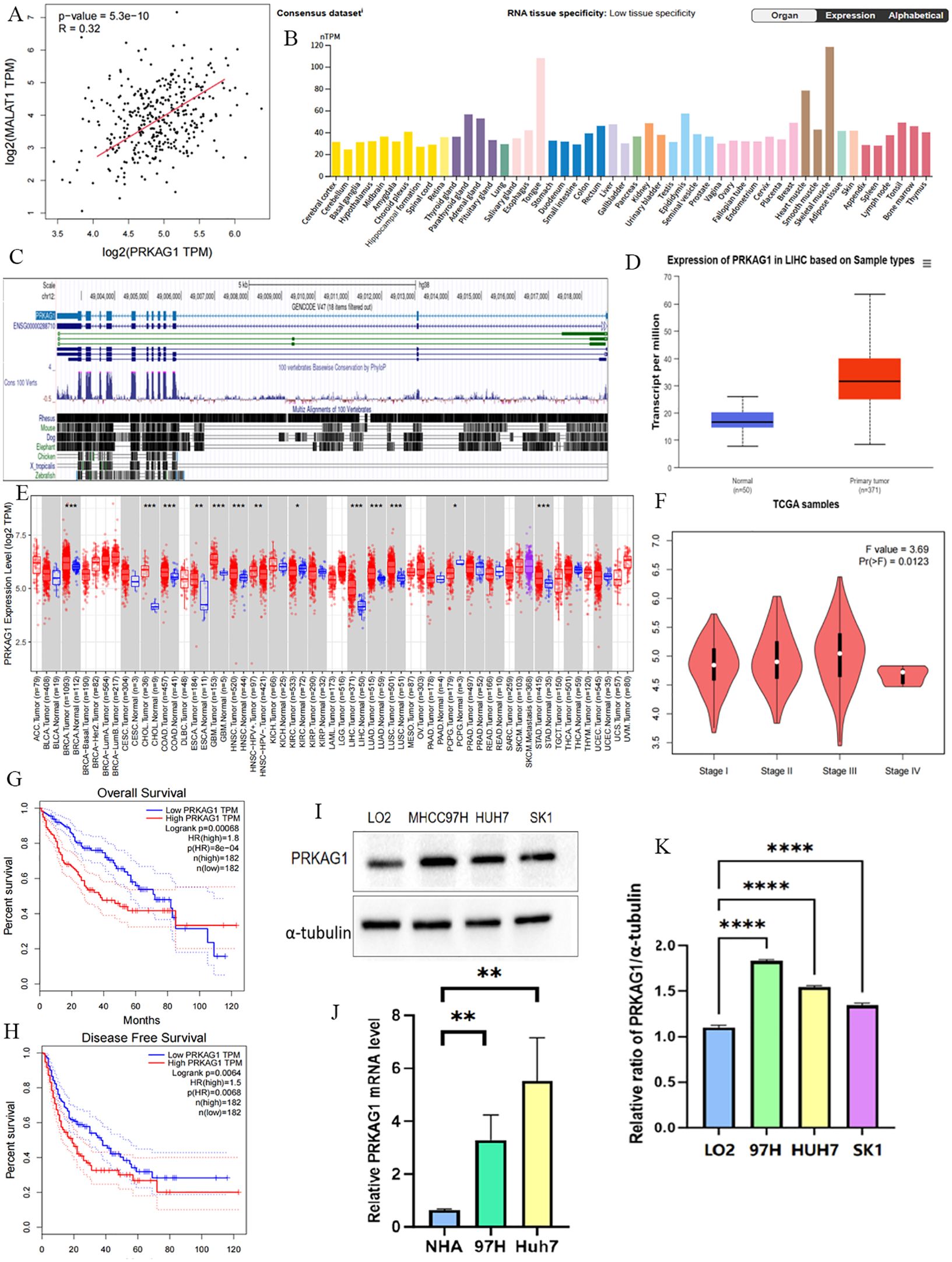 Composite image showing several data visualizations related to PRKAG1 expression. A: Scatter plot showing correlation. B: Bar chart of PRKAG1 expression across different tissues. C: Genomic view of PRKAG1. D: Box plot comparing PRKAG1 expression in normal vs. tumor samples. E: Box plots of PRKAG1 expression in various cancers. F: Violin plots of PRKAG1 expression across cancer stages. G and H: Kaplan-Meier curves for overall and disease-free survival based on PRKAG1 expression. I: Western blot of PRKAG1 in different cell lines. J and K: Bar charts showing expression ratios and mRNA levels in specified cells.