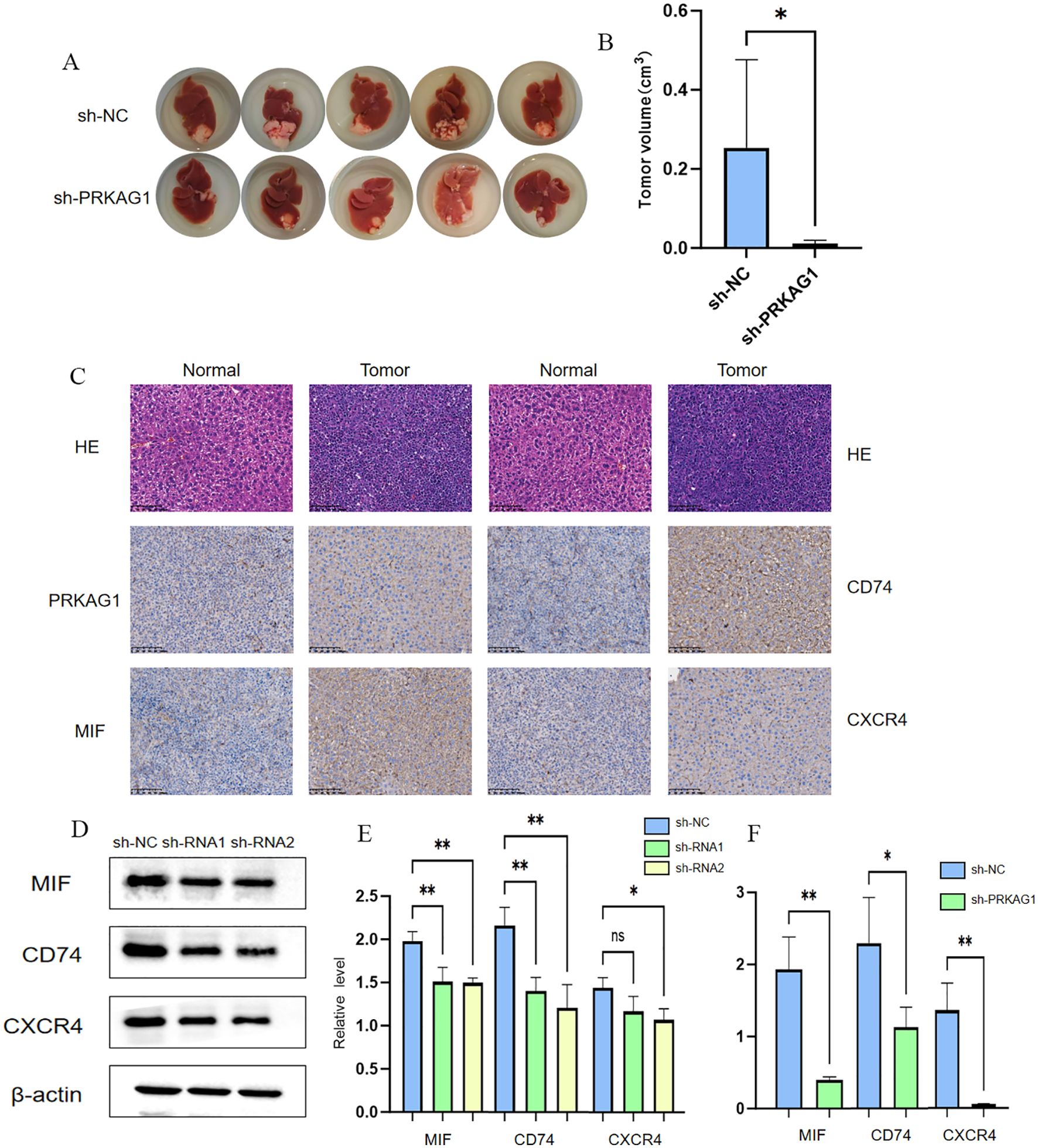 The image consists of multiple panels related to a scientific study. Panel A and B illustrate RNA sequences and target binding sites for hsa-miR-383-5p. Panel C presents predicted RNA secondary structures. Panels D to F show bar graphs comparing relative miR-383-5p mRNA levels across different cell lines and treatments. Panels G to J display Western blot results and corresponding bar graphs for RRKAG1 protein levels normalized to α-tubulin in MHCC97H and HUH7 cells. Panels K and L contain bar graphs of cell viability data, while Panel M includes Western blot analyses for P53, AKT, and phosphorylated AKT proteins. Statistical significance is noted with asterisks.