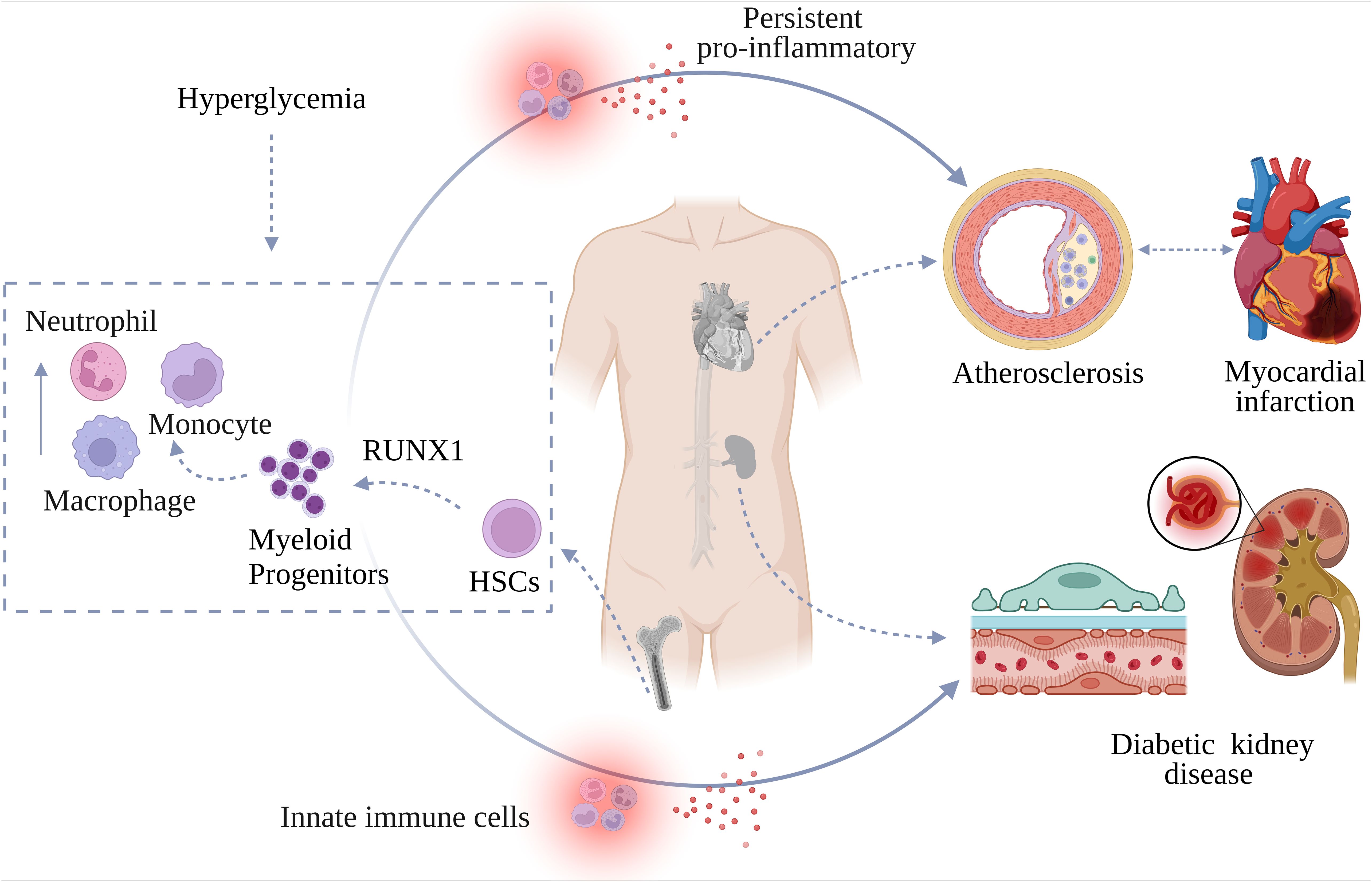 Diagram illustrating the progression from hyperglycemia to diabetic complications. Hyperglycemia leads to innate immune cell activation, causing persistent inflammation. This results in increased myeloid progenitors and RUNX1 expression, affecting hematopoietic stem cells (HSCs). The pro-inflammatory state contributes to atherosclerosis and myocardial infarction, as well as diabetic kidney disease, depicted with affected organs and pathways.