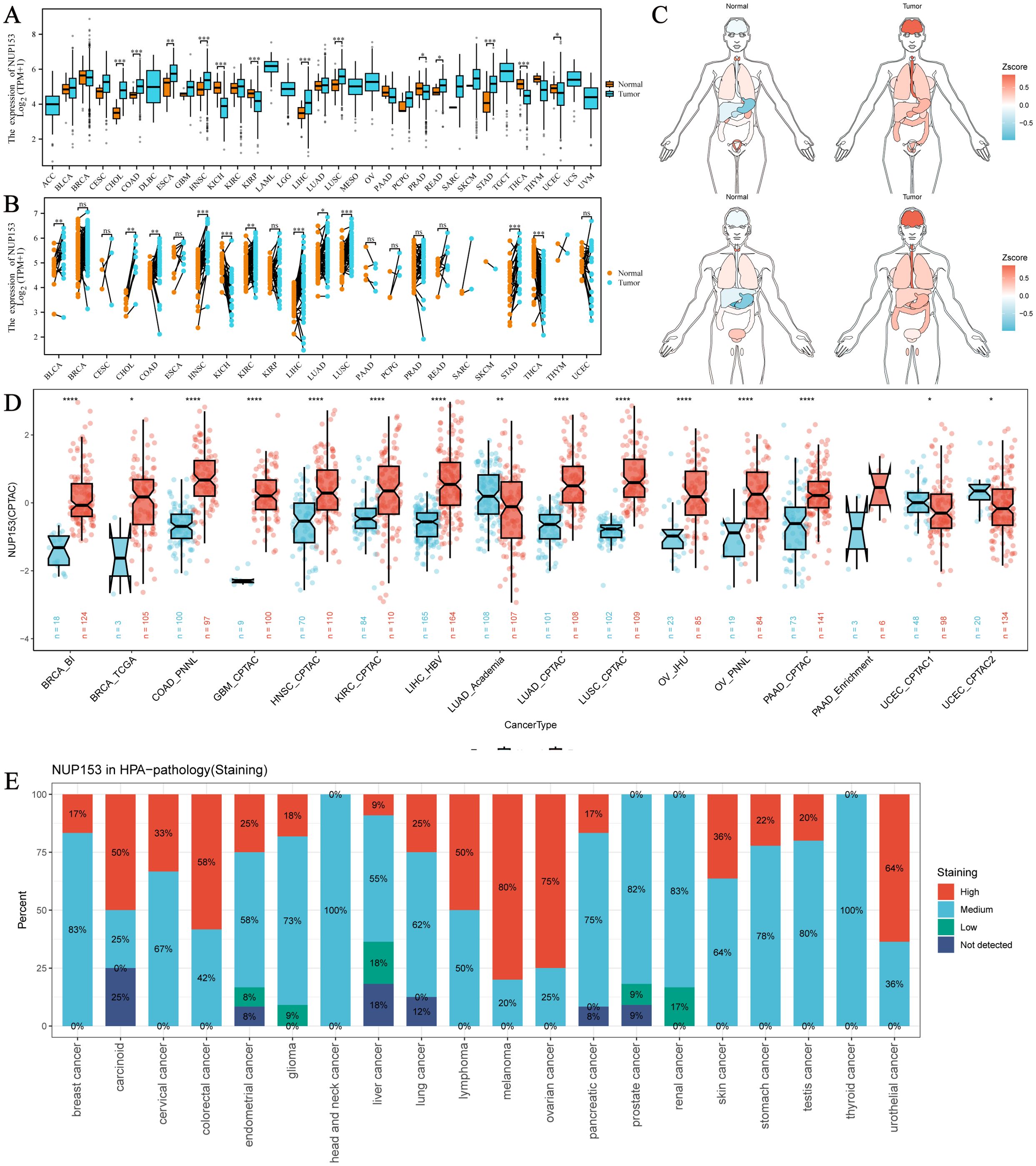 Composite image featuring multiple panels visualizing data related to cancer studies. Panel A shows a box plot comparing NUP153 expression in normal and tumor tissues across different cancer types. Panel B presents a similar dataset with paired line plots. Panel C includes illustrations of human bodies indicating regions with varying z-scores for NUP153 expression in normal and tumor conditions. Panel D provides box plots of NUP153 expression across various cancer types. Panel E displays a bar chart indicating levels of NUP153 staining in different cancers, highlighting proportions of high, medium, low, and undetected staining.