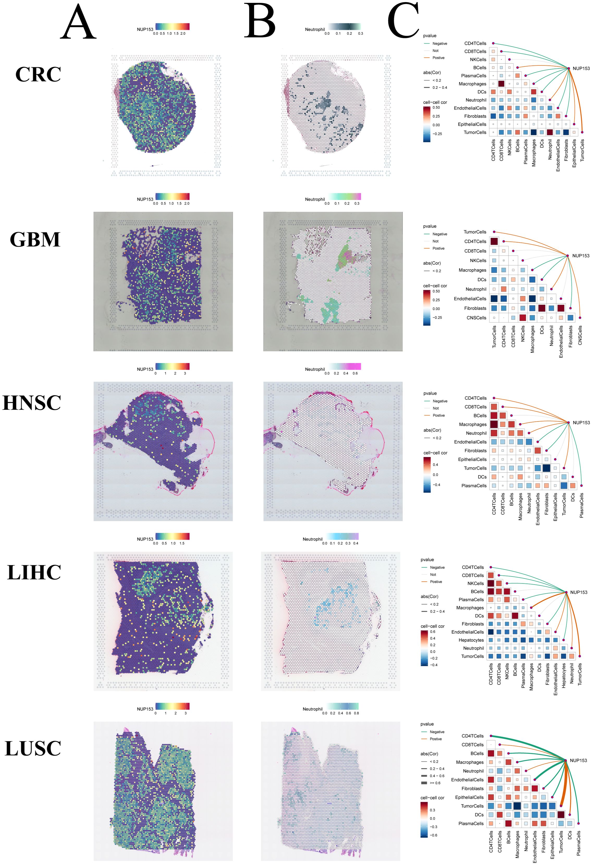 Visualization showing analysis of five cancer types: CRC, GBM, HNSC, LIHC, and LUSC. Each type is displayed with three panels labeled A, B, C. Panels A and B are color-coded heatmaps showing expression levels of markers NUP153 and neutrophils, respectively. Panel C features correlation matrices and graphs illustrating interactions between different cell types and NUP153 expression.