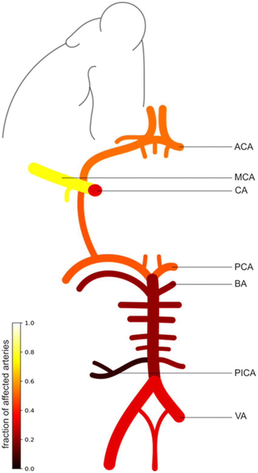Diagram of a mouse's cerebral arteries, illustrating the fraction of affected arteries with color coding. The anterior cerebral artery (ACA), middle cerebral artery (MCA), and cerebellar arteries (CA) are highlighted. A vertical scale bar indicates fractions from zero to one, using colors from black (zero) to yellow (one).