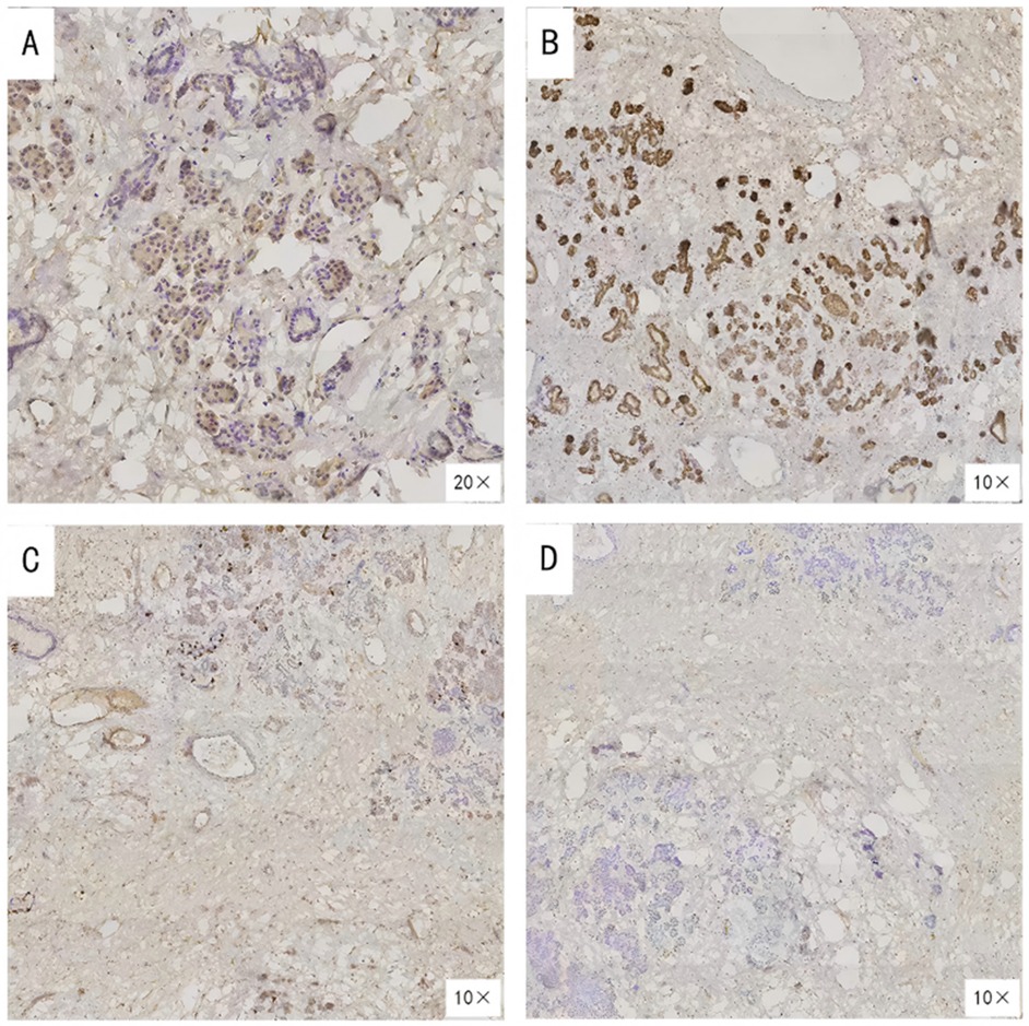 Histological images labeled A through D show tissue samples under different magnifications. Image A is at 20x magnification, highlighting cell structures. Images B, C, and D are at 10x magnification, displaying varying degrees of staining and cell patterns.