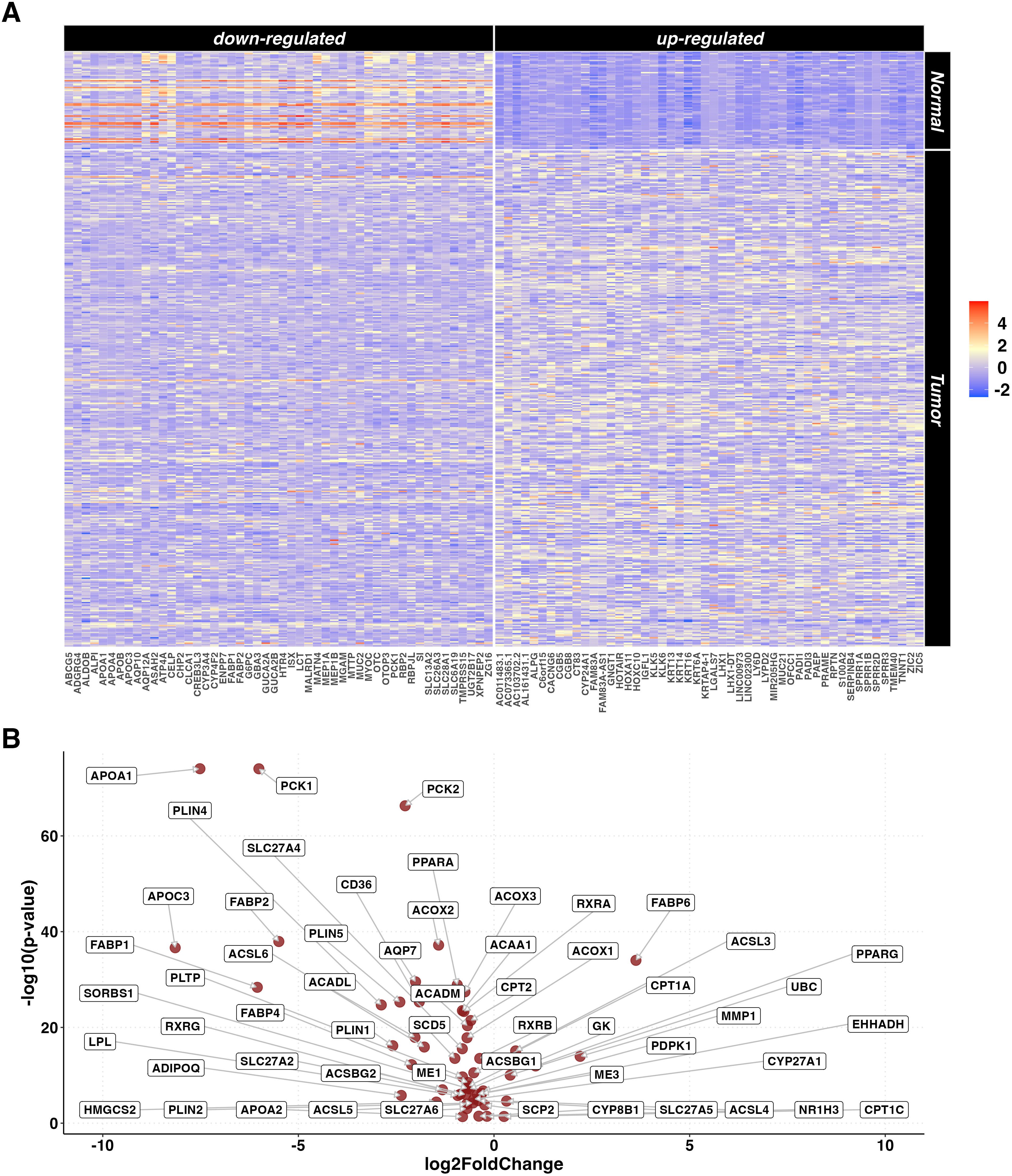 Heatmap and volcano plot showing gene expression. Panel A displays a heatmap with gene expressions in normal and tumor samples, divided into down-regulated (left) and up-regulated (right) sections, using a color scale from blue (down-regulated) to red (up-regulated). Panel B presents a volcano plot of -log10 p-values versus log2 fold change for various genes, highlighting significant changes in expression.