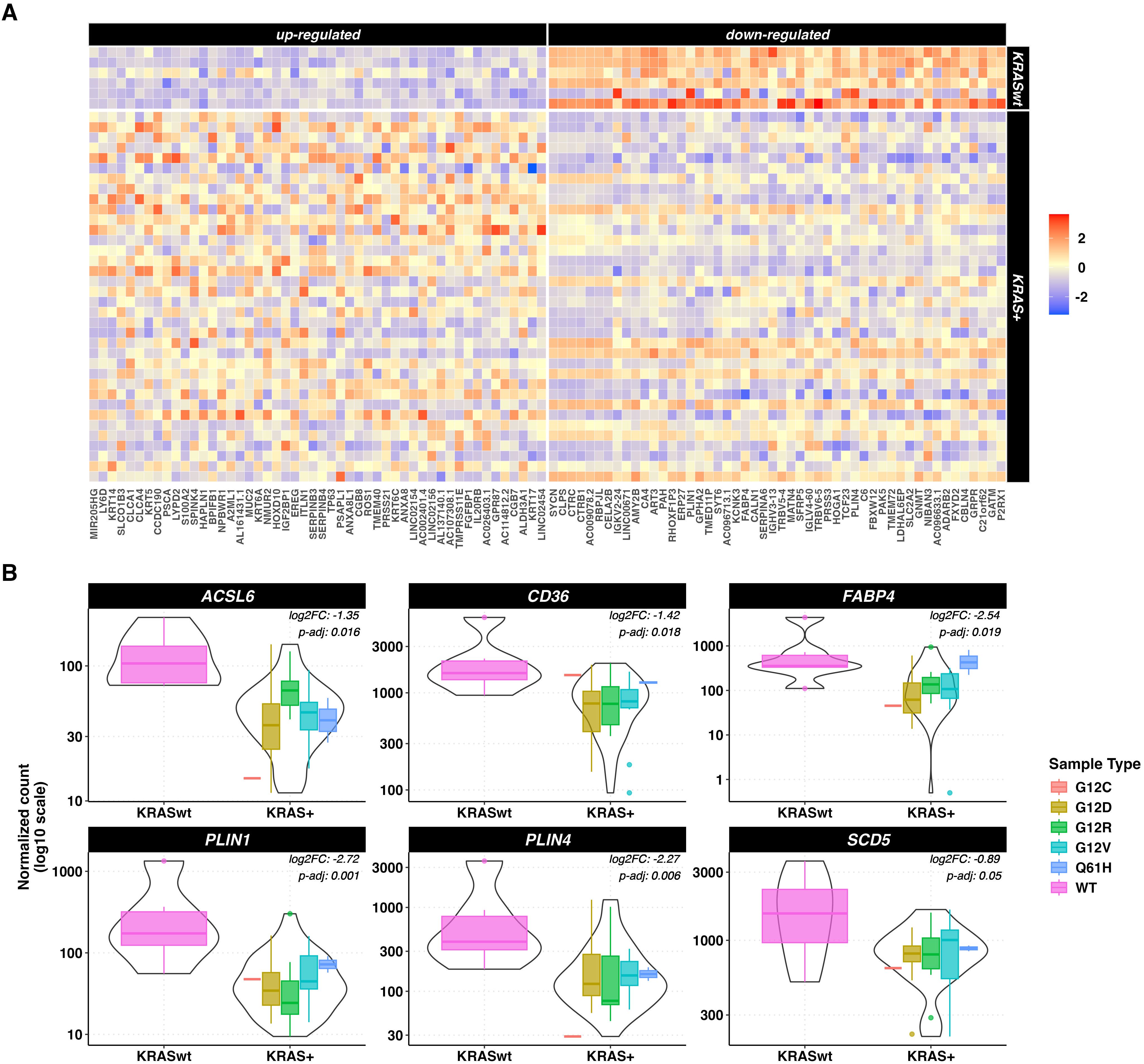 Heatmap (A) shows gene expression levels in up-regulated and down-regulated genes, comparing KRAS mutant and wild-type samples. Higher expression is in red; lower in blue. Violin plots (B) display normalized counts for genes ACSL6, CD36, FABP4, PLIN1, PLIN4, and SCD5, with statistical annotations, grouped by KRAS status and sample type.