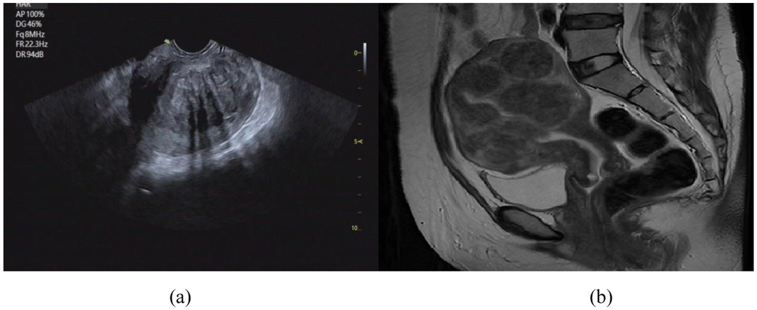 Panel (a) shows an ultrasound image featuring a tubular structure with varying shades indicating different tissue densities. Panel (b) is an MRI scan highlighting abdominal structures, including the spine and organs, in cross-section, with various shades denoting tissue contrast.