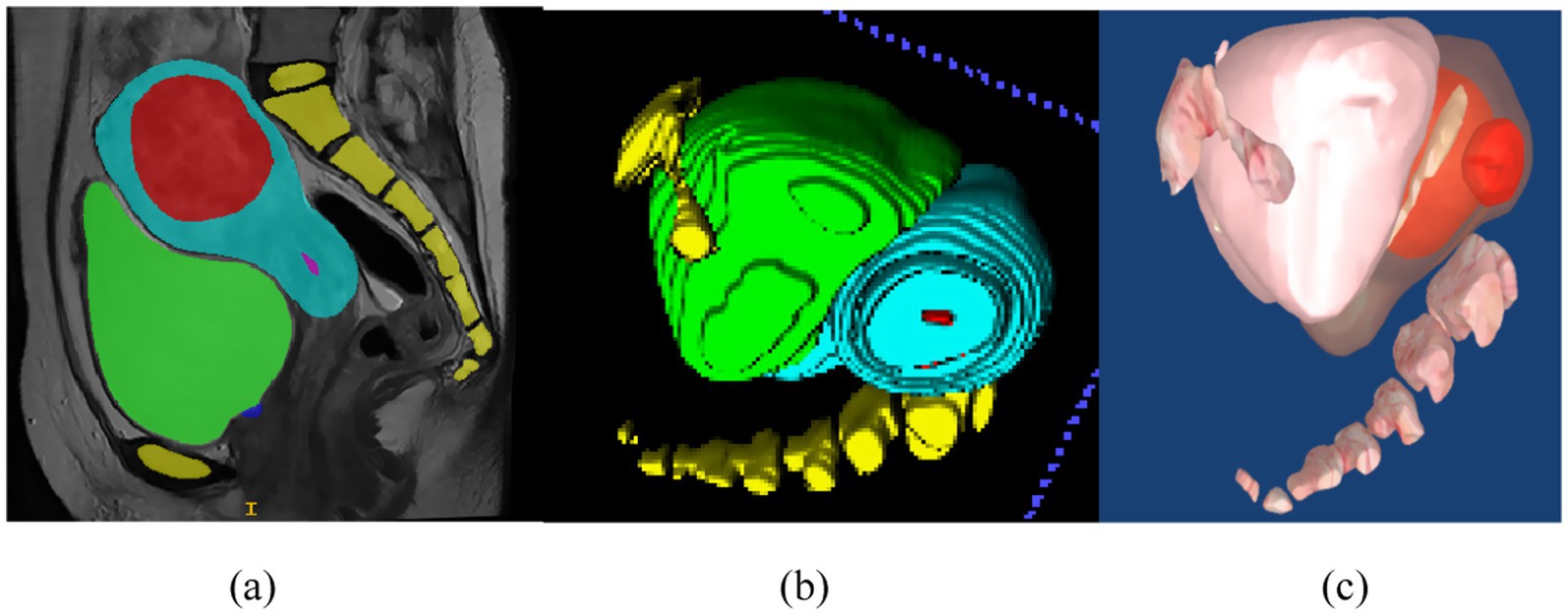 Three-panel image depicting fetal anatomy using different visualization techniques. Panel (a) shows a cross-sectional MRI with color-coded anatomical features. Panel (b) presents a contour model highlighting similar structures in yellow, green, and blue. Panel (c) displays a 3D rendering of the fetus, focusing on the skeletal structure and spatial orientation.