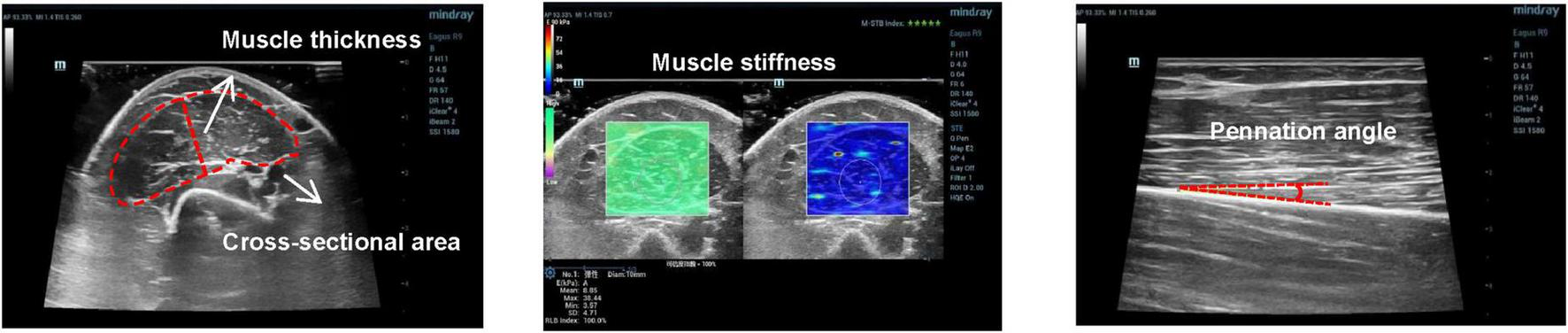 Ultrasound images illustrating muscle parameters. The first image shows muscle thickness and cross-sectional area with red outlines and arrows. The second image highlights muscle stillness with two squares, one green and one blue. The third image displays a pennation angle marked with a red line and dotted guideline.