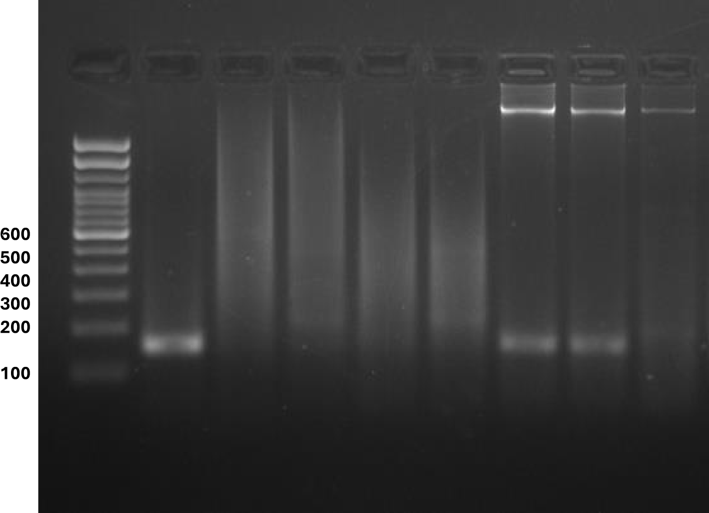 A gel electrophoresis image with nine lanes labeled M and 1 through 8. Lane M contains a DNA ladder with visible bands from 100 to 600 base pairs. Lane 1 shows a clear band at approximately 155 base pairs. Lanes 2 through 5 display faint or no bands, indicating weak or absent DNA amplification. Lanes 6 to 8 show strong upper bands near the well region, suggesting possible high-molecular-weight DNA or primer-dimer accumulation, but no visible bands at 155 base pairs.