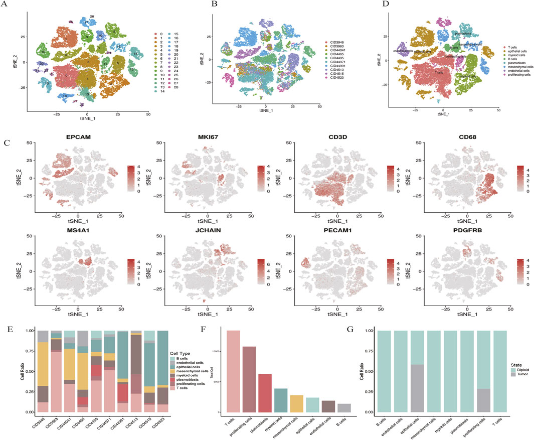 A collection of images showing tSNE plots and bar charts related to cell types and gene expression. Panels A, B, and D present clustered tSNE plots, with variations in color representing different clusters and cell types. Panel C shows multiple tSNE plots indicating specific gene expression levels, highlighted in red. Panel E is a stacked bar chart displaying cell type ratios across different samples. Panel F is a bar chart showing cell type distributions across various categories. Panel G is a bar chart comparing cell ratios between two states: normal and tumor.