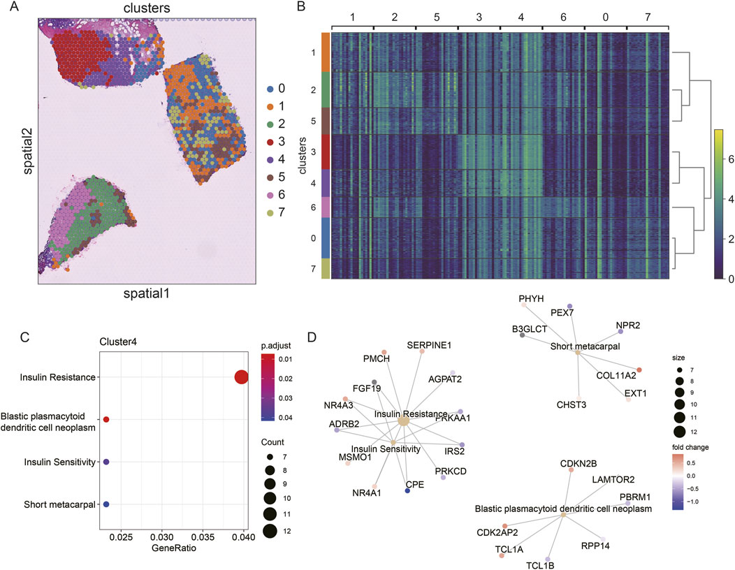 Four-panel figure showing clustering analysis and related data: A: Spatial visualization with colored clusters labeled 0 to 7, mapped on spatial axes. B: Heatmap displaying expression levels across clusters, with a dendrogram indicating similarity. C: Dot plot for Cluster 4, showing gene ratios and significance for terms like Insulin Resistance and Blastic Plasmacytoid Dendritic Cell Neoplasm. D: Network plot linking genes, showing sizes and fold changes with color indicators.