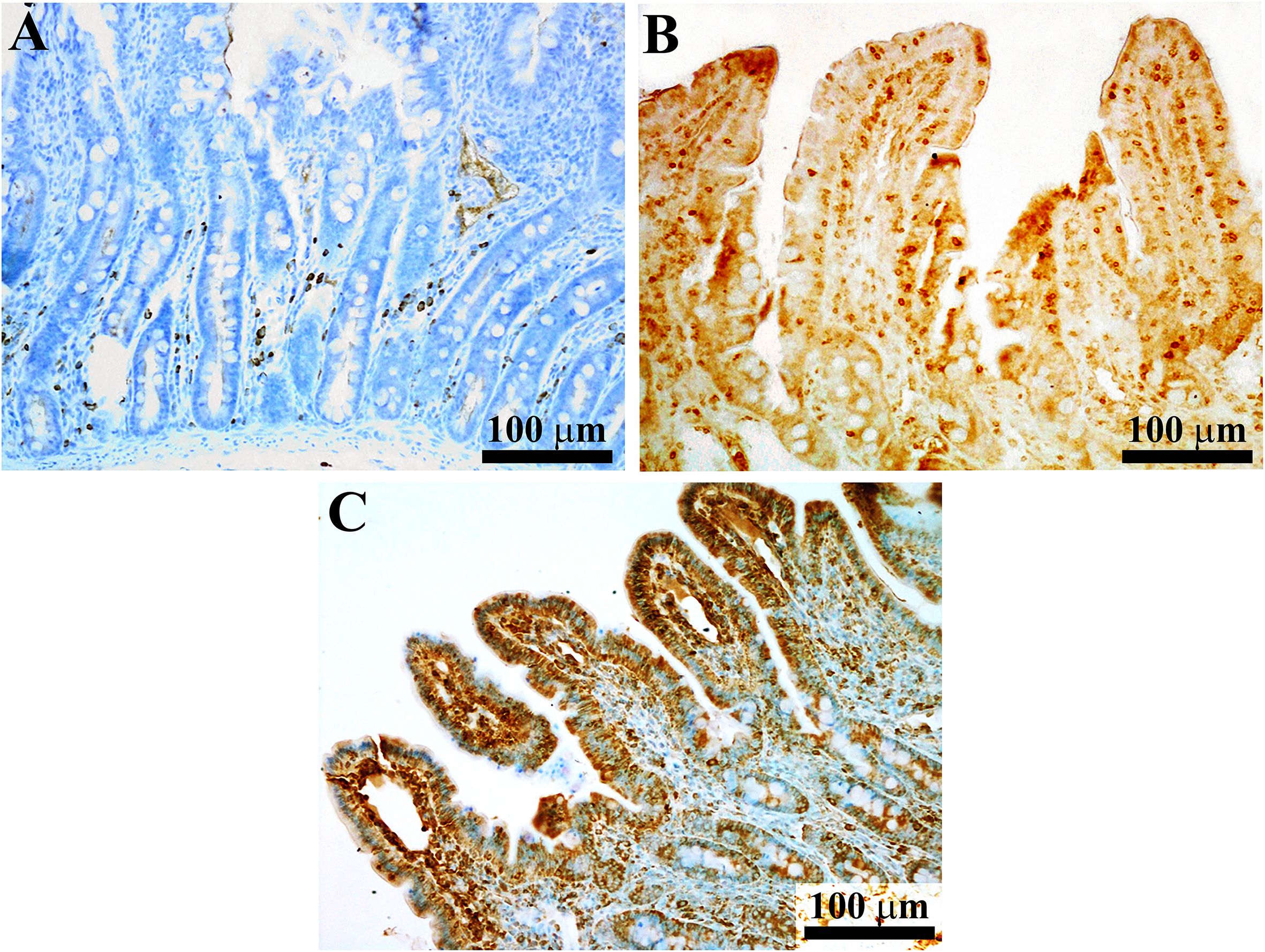 Microscopic images labeled A, B, and C show tissue sections. Image A and C display a tissue with a blue hue. All images show cellular structures and scale bars marking 100 micrometers.