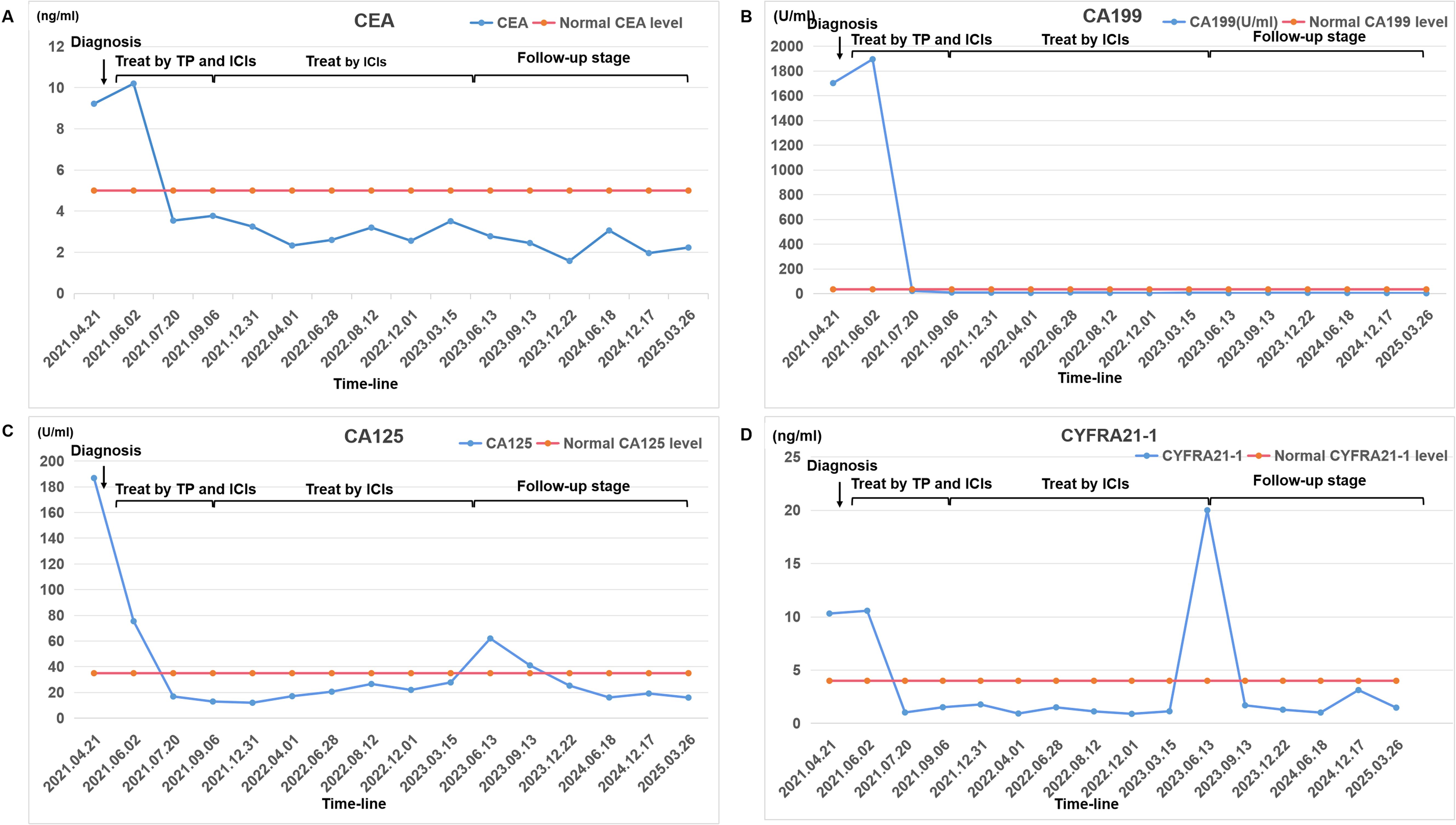 Four line graphs depicting tumor marker levels over time. Graph A shows CEA levels, initially high at diagnosis, decreasing and stabilizing around the normal level. Graph B illustrates CA199 levels, dropping sharply post-diagnosis and remaining at the normal level. Graph C displays CA125 levels, which decrease significantly after diagnosis and stabilize near the normal level. Graph D presents CYFRA21-1 levels, decreasing post-diagnosis with a spike during treatment by ICIs, then fall back near normal. Each graph includes stages of treatment: “Treat by TP and ICIs,” “Treat by ICIs,” and “Follow-up stage.