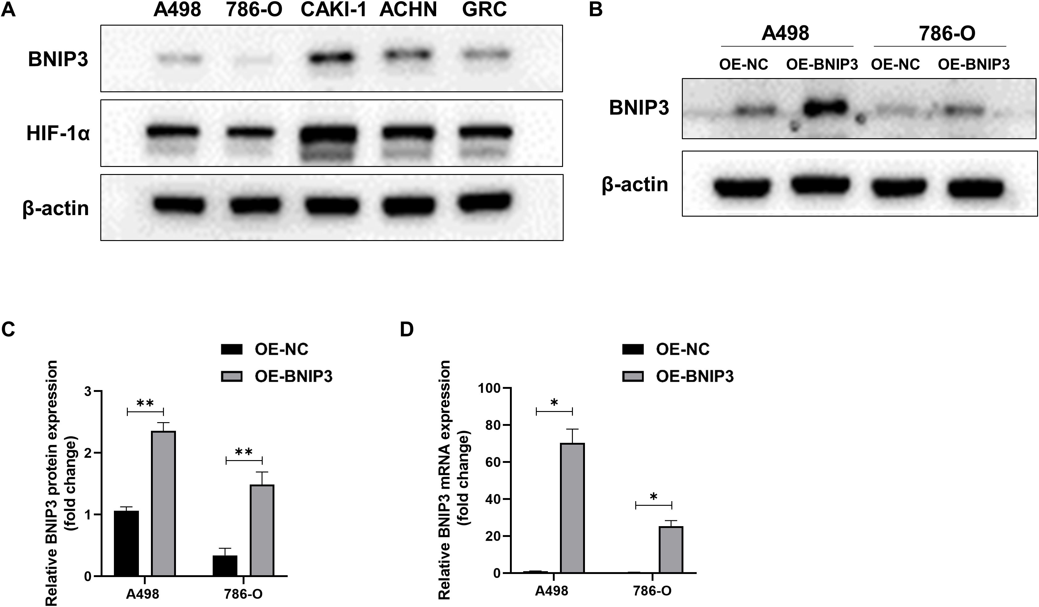 Western blot and bar graphs depict the expression of BNIP3, HIF-1α, and β-actin in different cell lines. Panel A shows protein expression in A498, 786-O, CAKI-1, ACHN, and GRC cells. Panel B highlights BNIP3 and β-actin levels in A498 and 786-O with OE-NC and OE-BNIP3 treatments. Panels C and D present bar graphs of relative BNIP3 protein and mRNA expression, respectively, comparing OE-NC and OE-BNIP3 in A498 and 786-O cells. Significant differences are indicated with asterisks.
